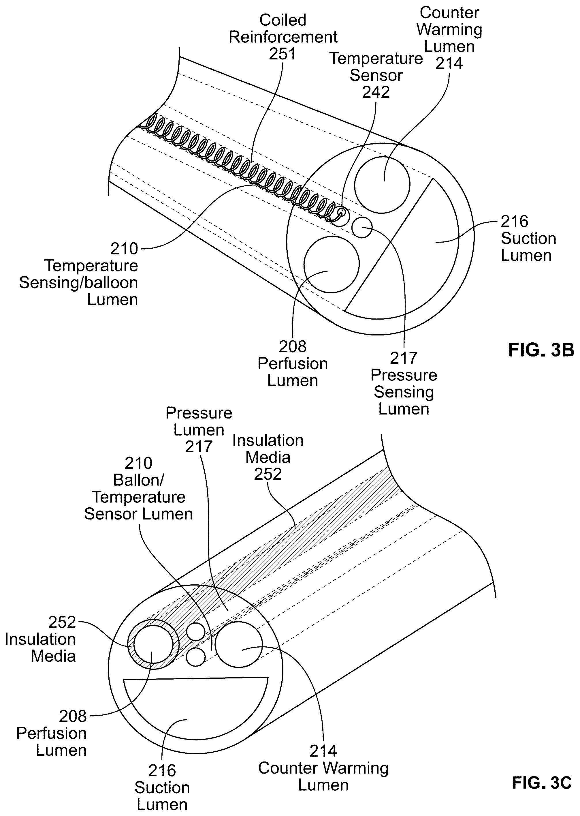 Patent US12097345 Figure 5 – Infusion catheter and methods of use