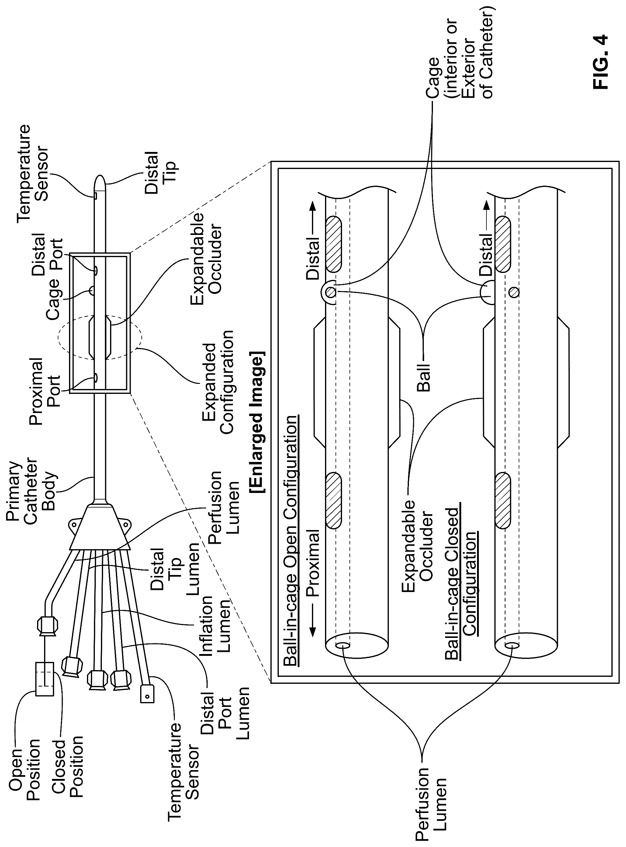 Patent US12097345 Figure 6 – Infusion catheter and methods of use