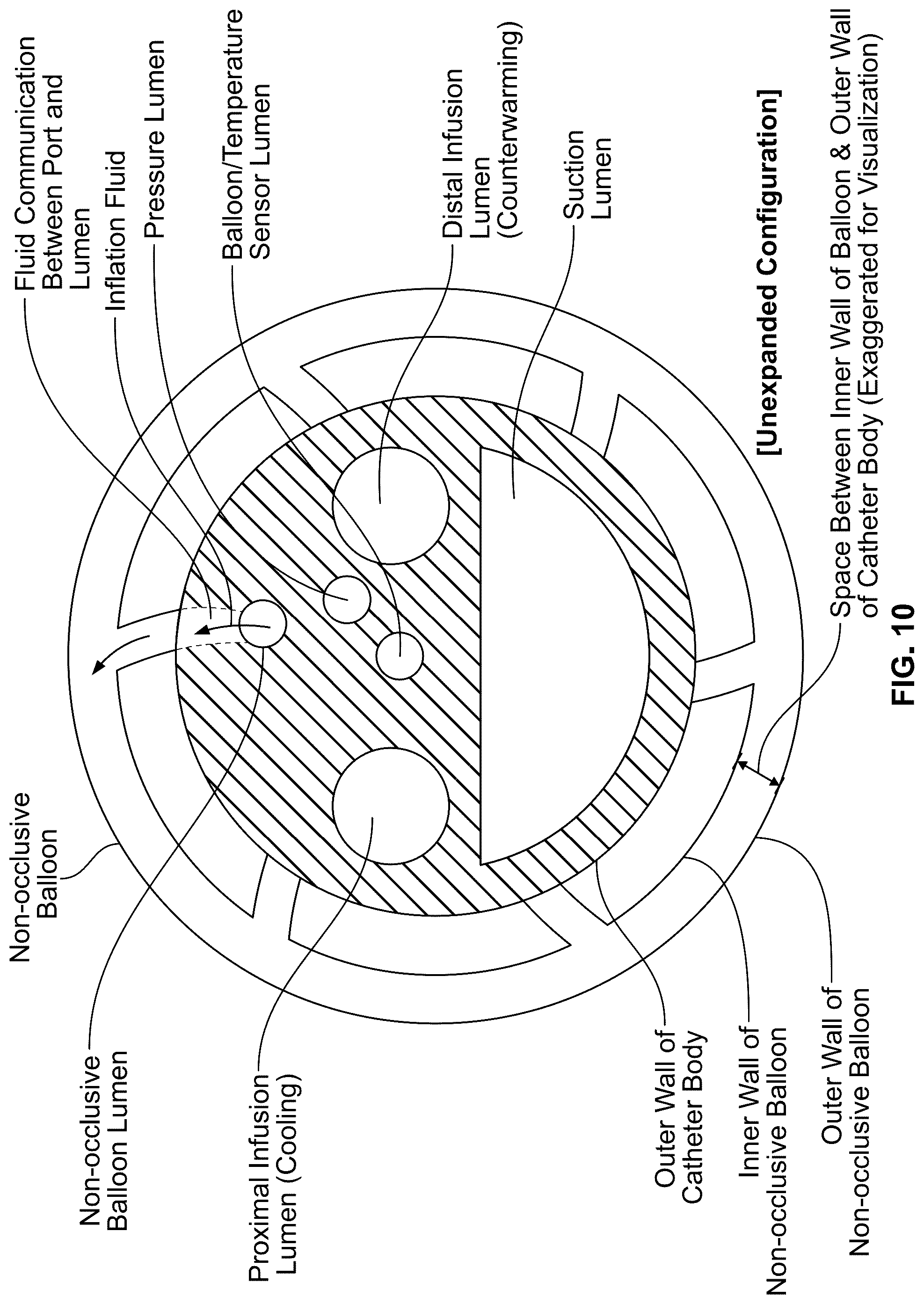 Patent US12097345 Figure 12 – Infusion catheter and methods of use