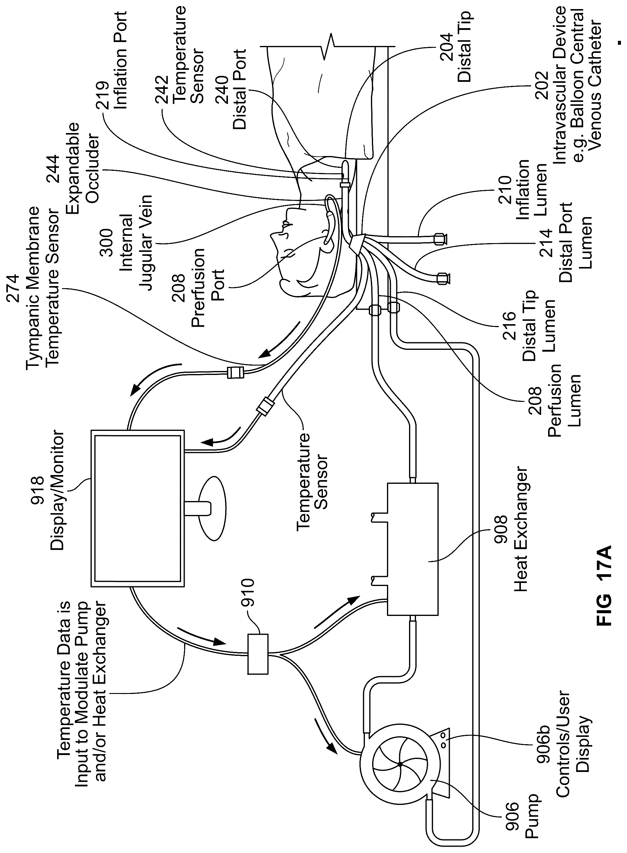 Patent US12097345 Figure 19 – Infusion catheter and methods of use