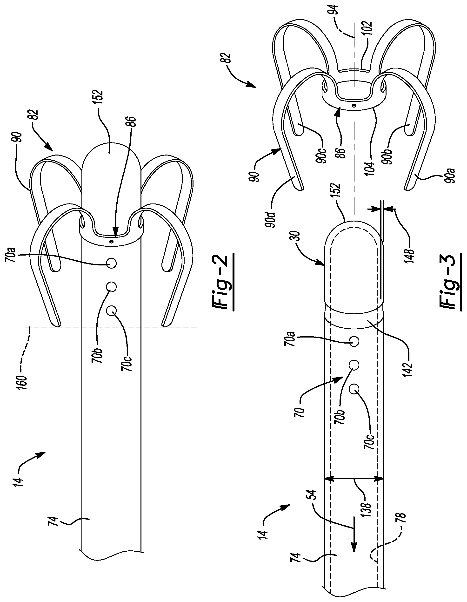 Patent US12097347 Figure 2 – System and method for a shunt