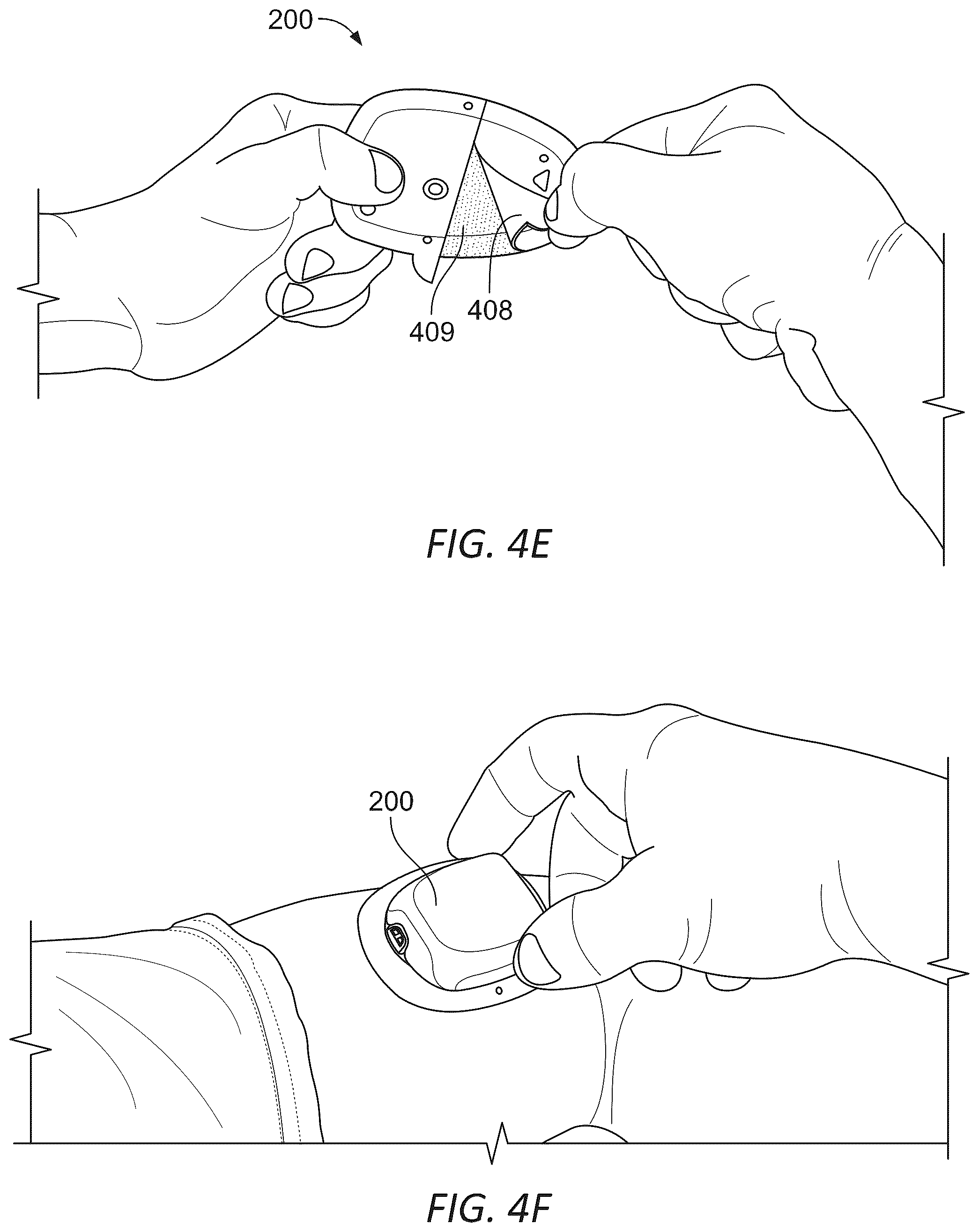 Patent US12097352 Figure 6 – Wearable micro-dosing drug delivery device