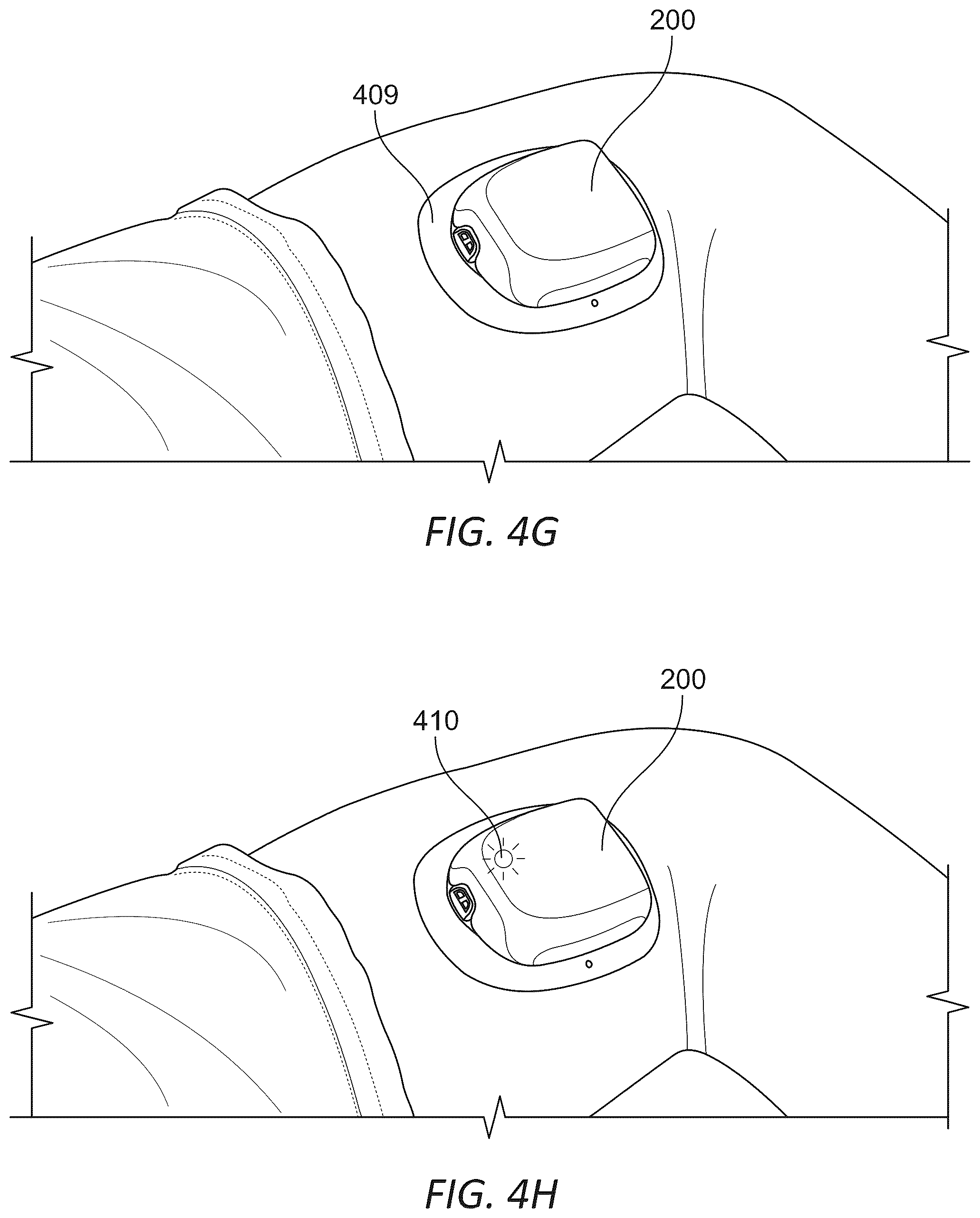 Patent US12097352 Figure 7 – Wearable micro-dosing drug delivery device
