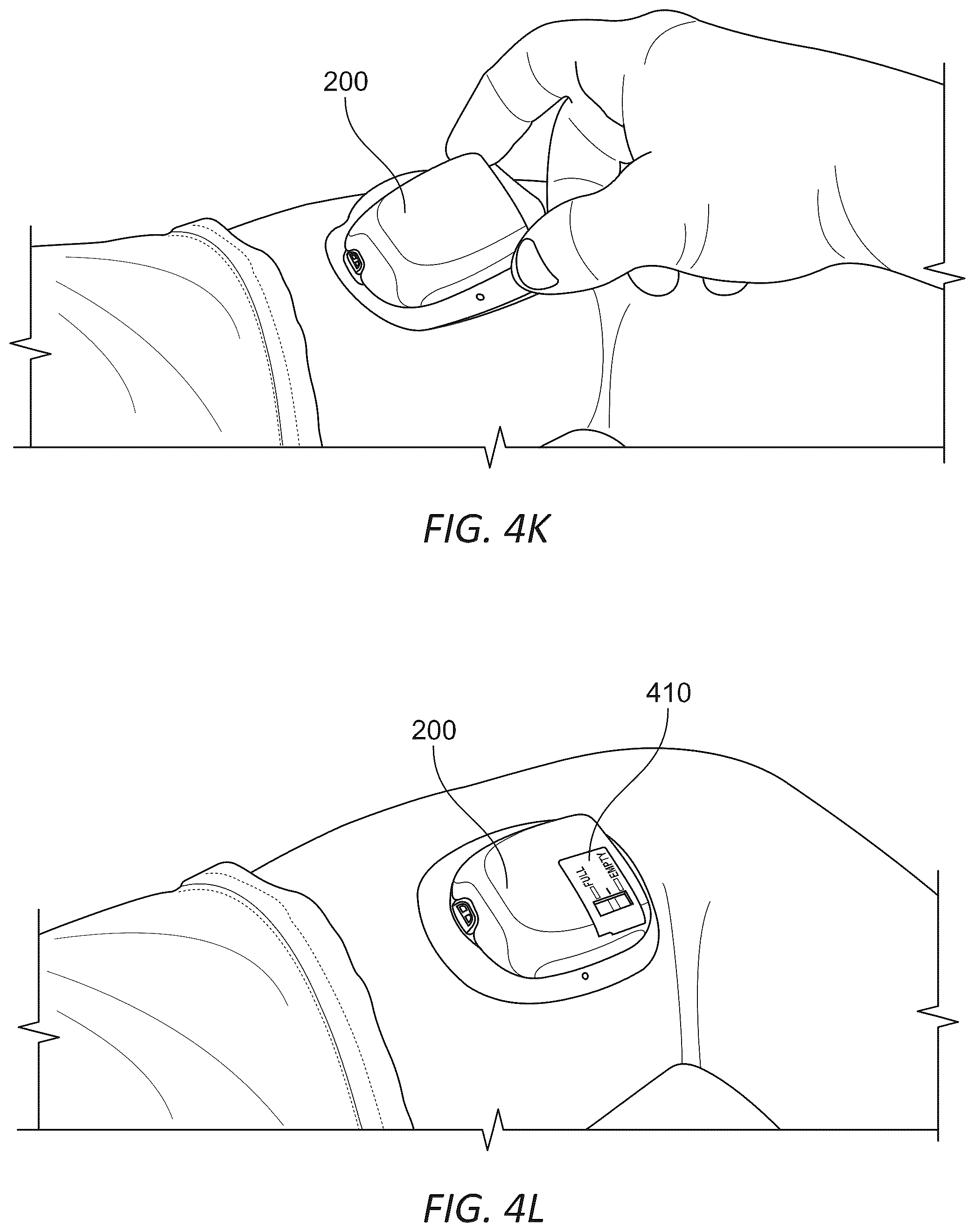 Patent US12097352 Figure 9 – Wearable micro-dosing drug delivery device