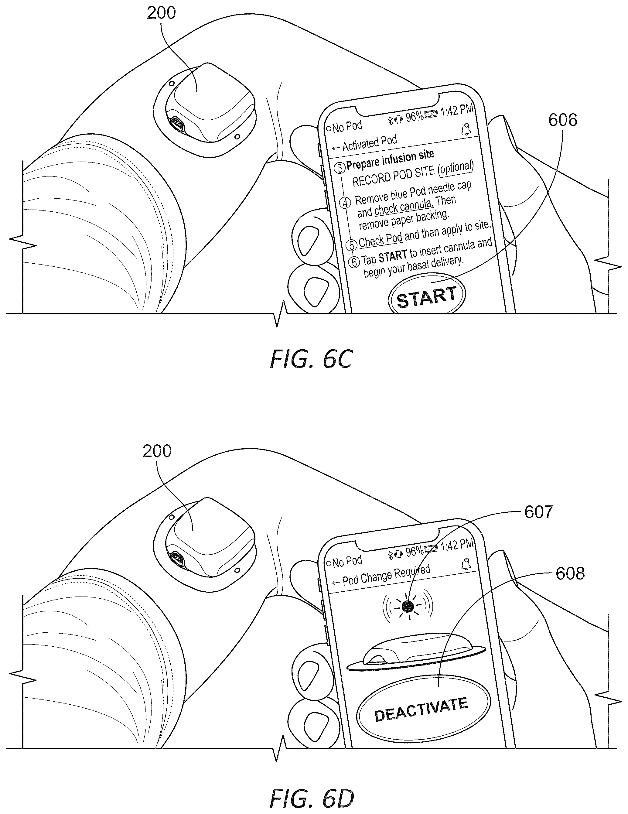 Patent US12097352 Figure 12 – Wearable micro-dosing drug delivery device