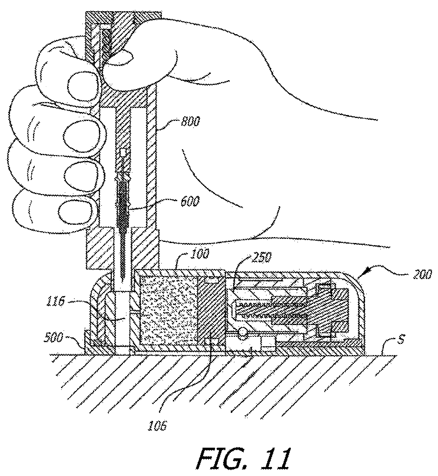 Patent US12097353 Figure 7 – Infusion pumps