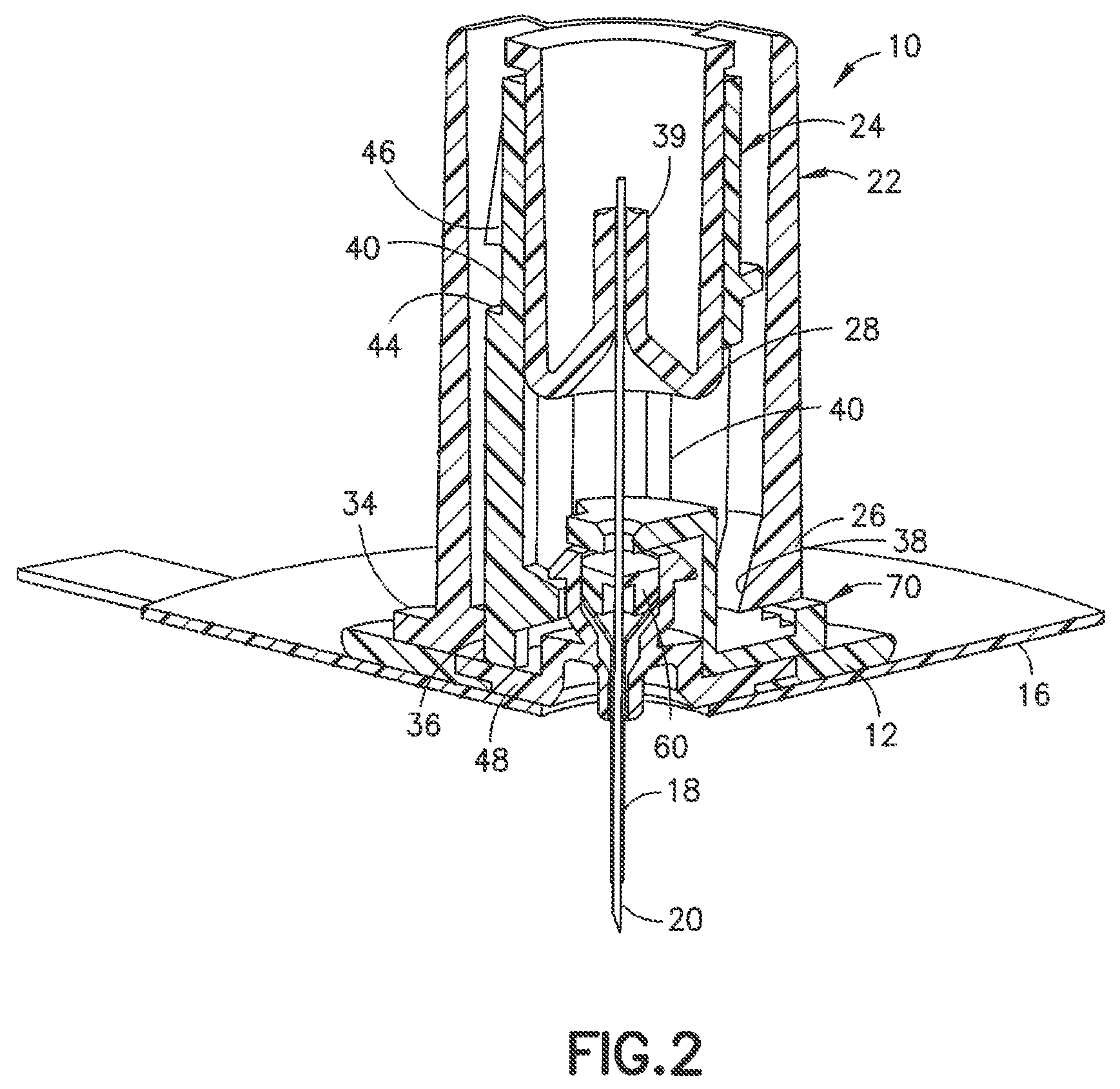 Patent US12097354 Figure 2 – Infusion device with stabilizer member