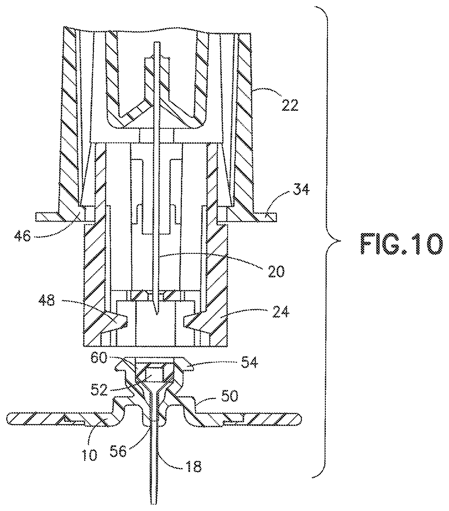 Patent US12097354 Figure 8 – Infusion device with stabilizer member