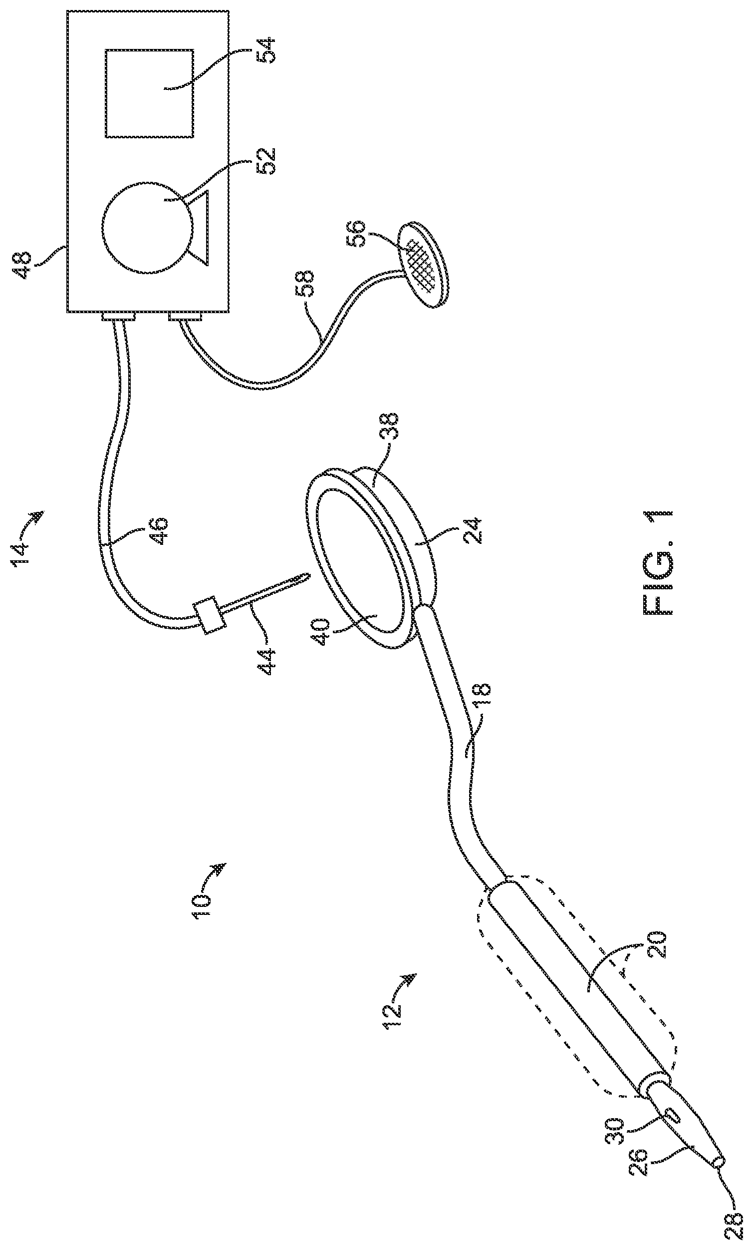 Patent US12097364 Figure 1 – Apparatus, systems, and methods for percutaneous pneumatic cardiac assistance