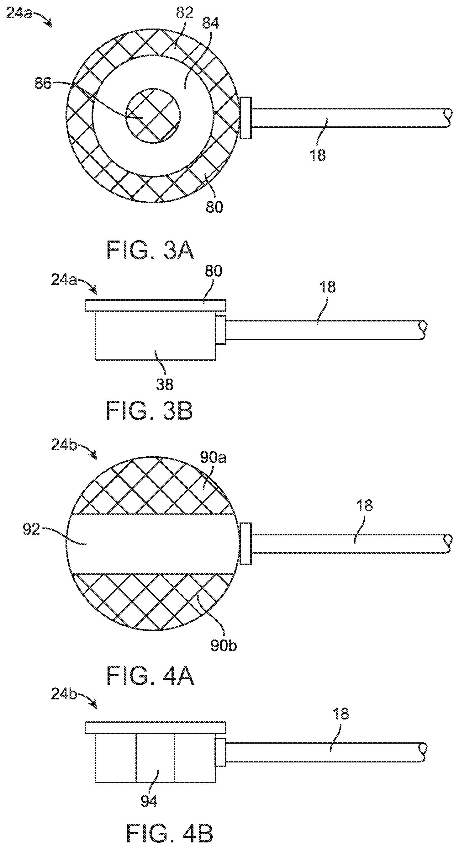 Patent US12097364 Figure 4 – Apparatus, systems, and methods for percutaneous pneumatic cardiac assistance