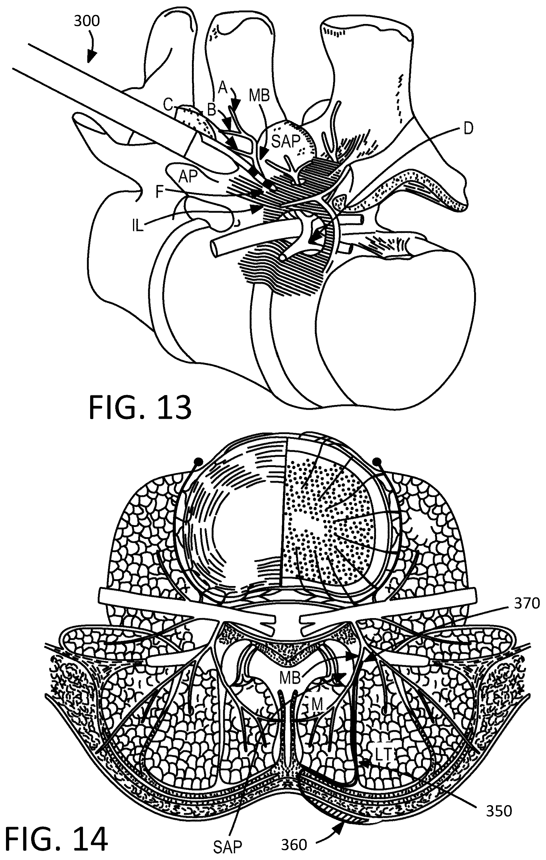 Patent US12097365 Figure 8 – Electrical stimulator for the treatment of back pain and methods of use