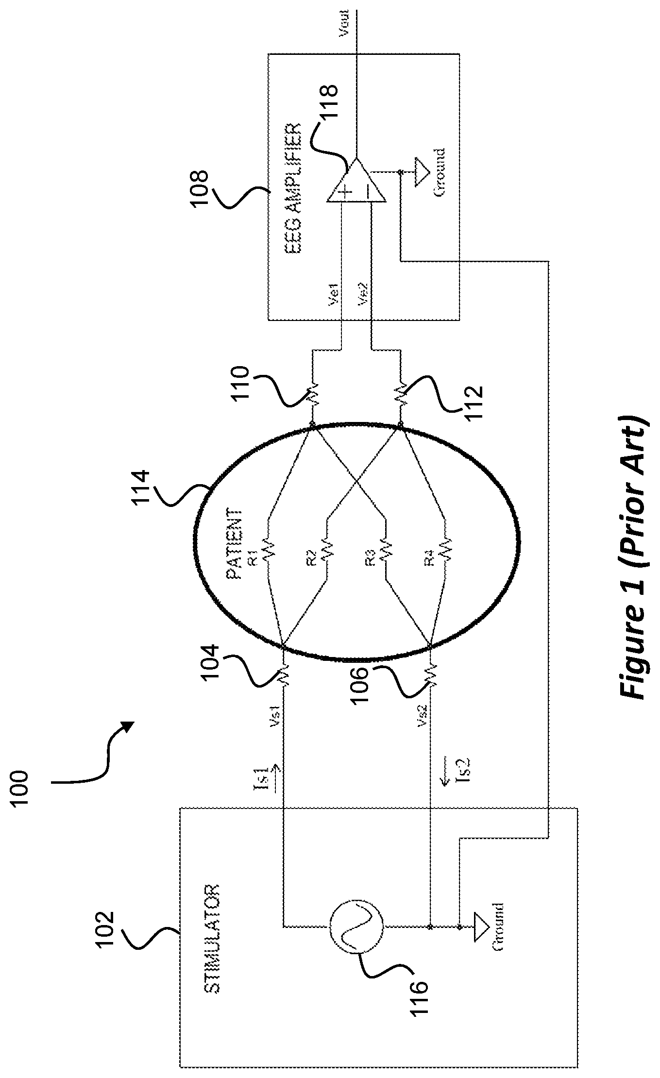 Patent US12097366 Figure 1 – Systems and methods for monitoring neural activity