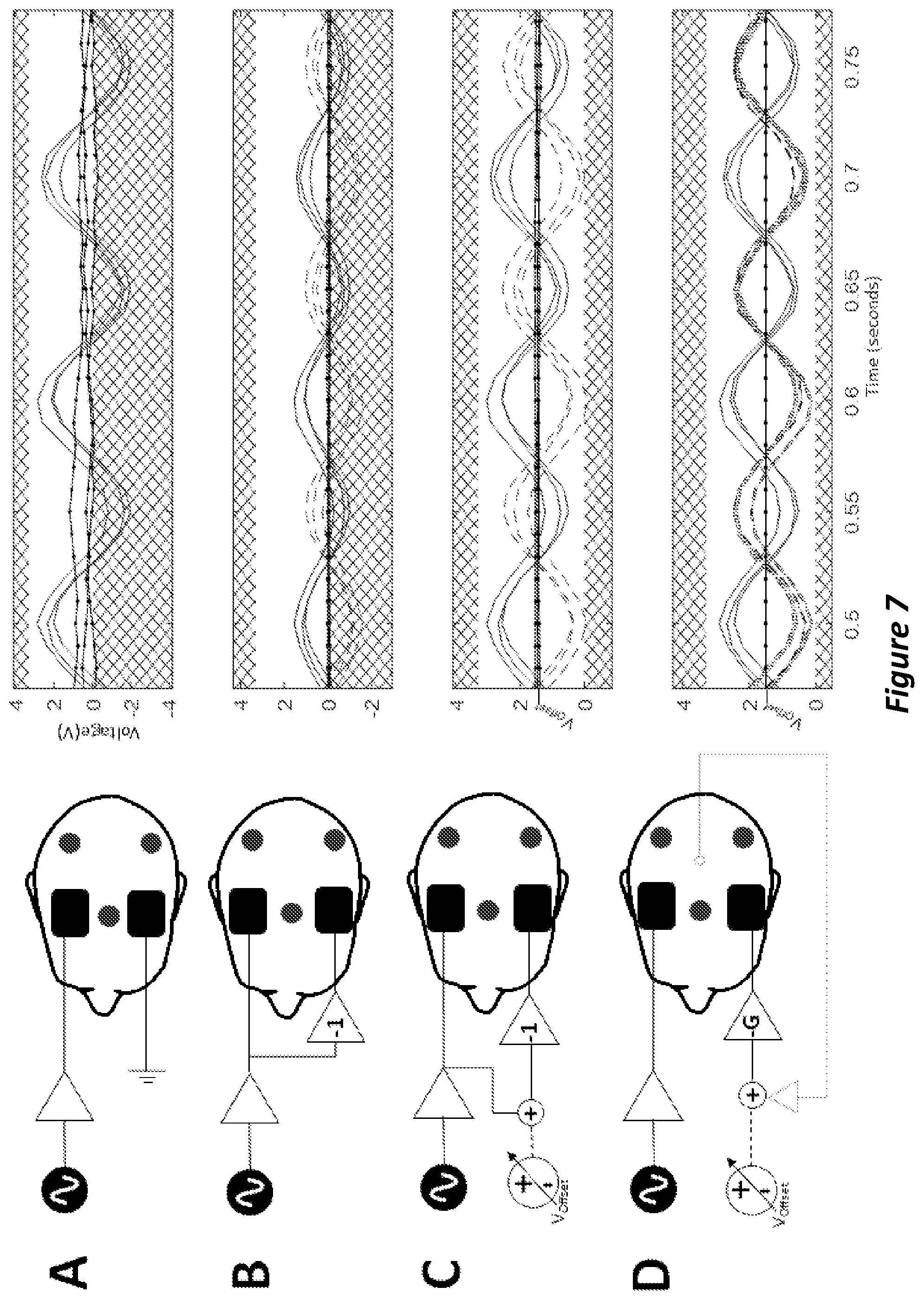 Patent US12097366 Figure 7 – Systems and methods for monitoring neural activity