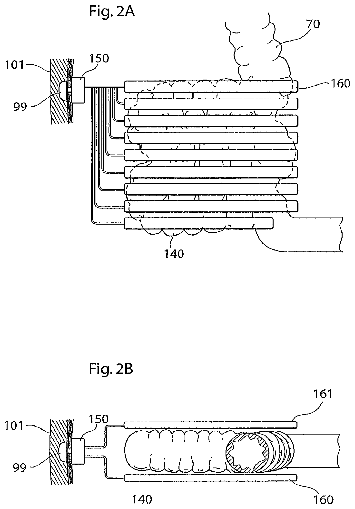 Patent US12097368 Figure 3 – System for treating a patient having an intestinal disorder