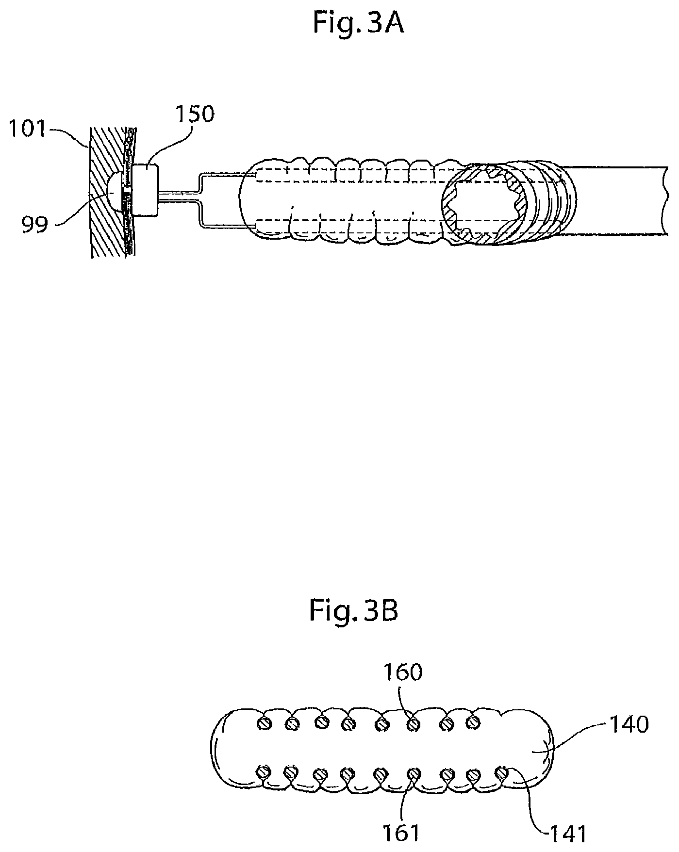 Patent US12097368 Figure 4 – System for treating a patient having an intestinal disorder