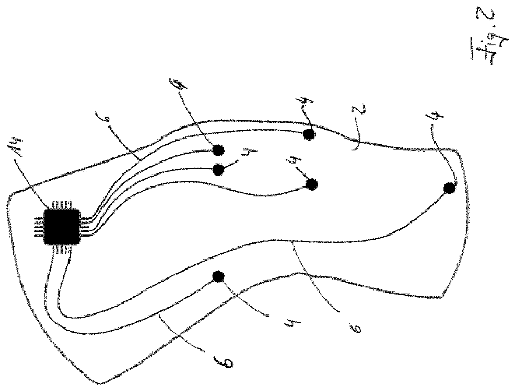 Patent US12097369 Figure 2 – Orthopedic device