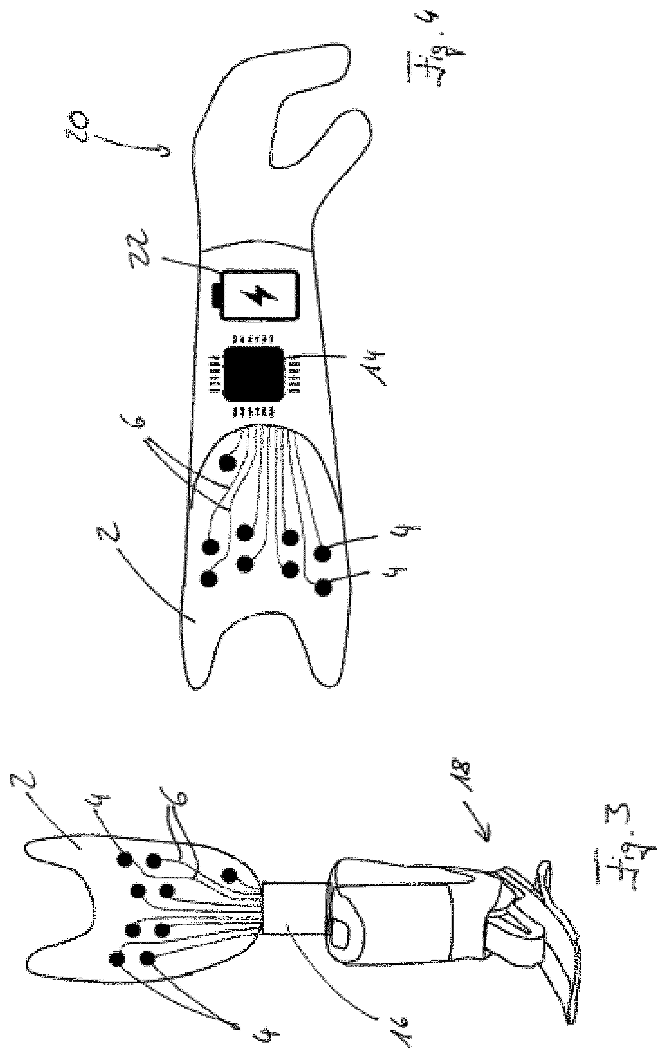 Patent US12097369 Figure 3 – Orthopedic device