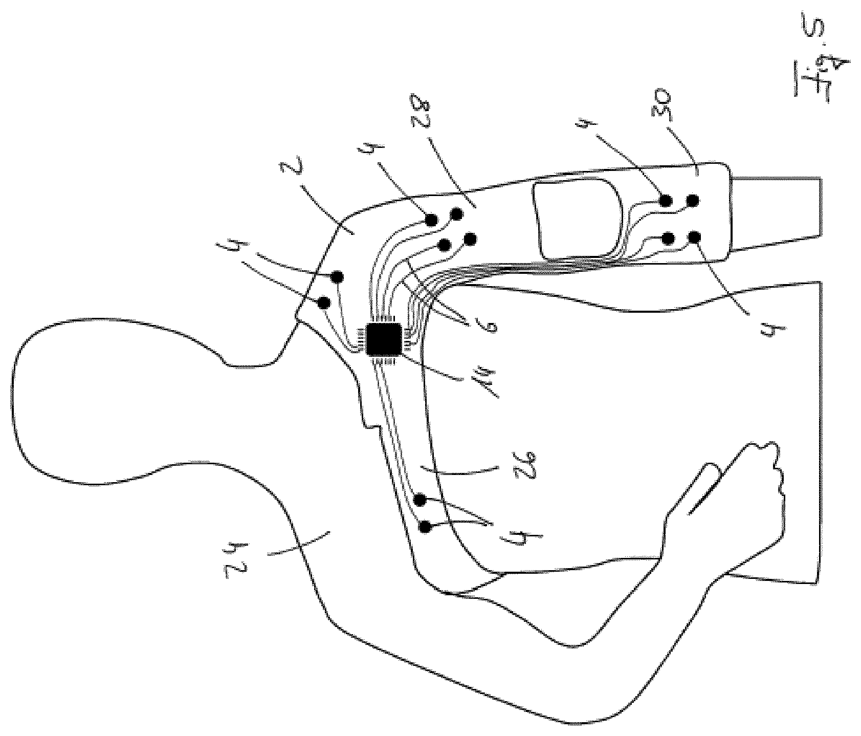 Patent US12097369 Figure 4 – Orthopedic device