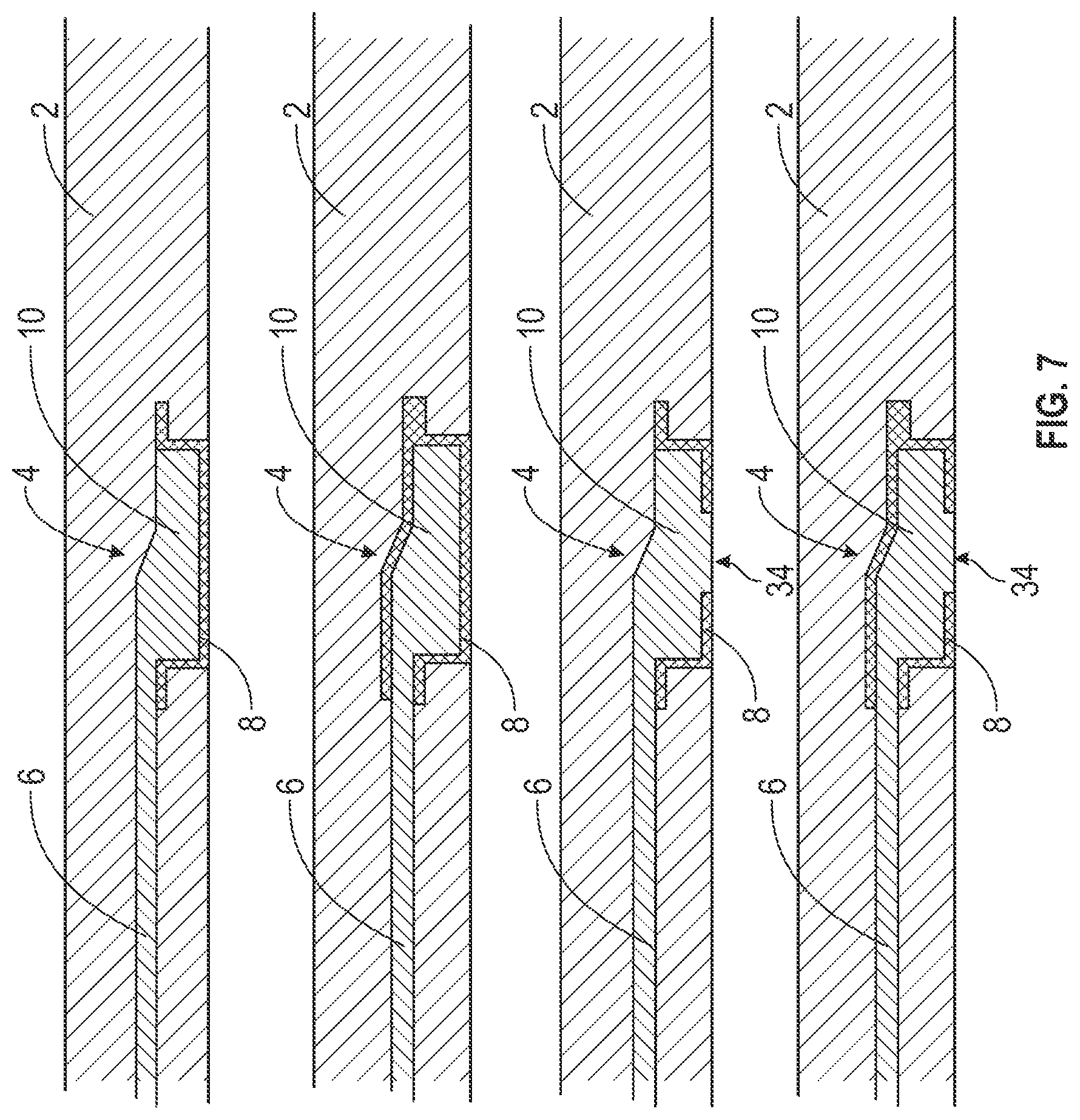 Patent US12097369 Figure 6 – Orthopedic device