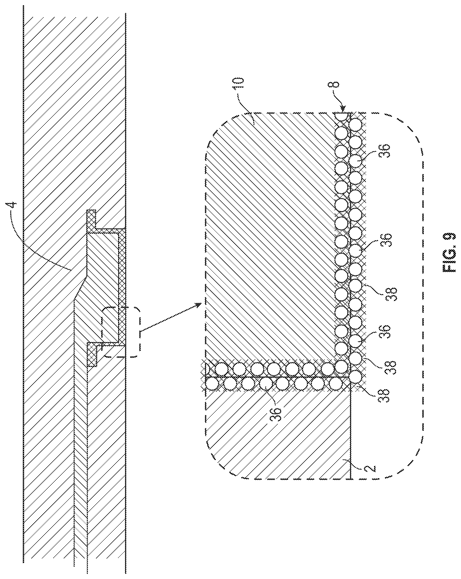 Patent US12097369 Figure 8 – Orthopedic device
