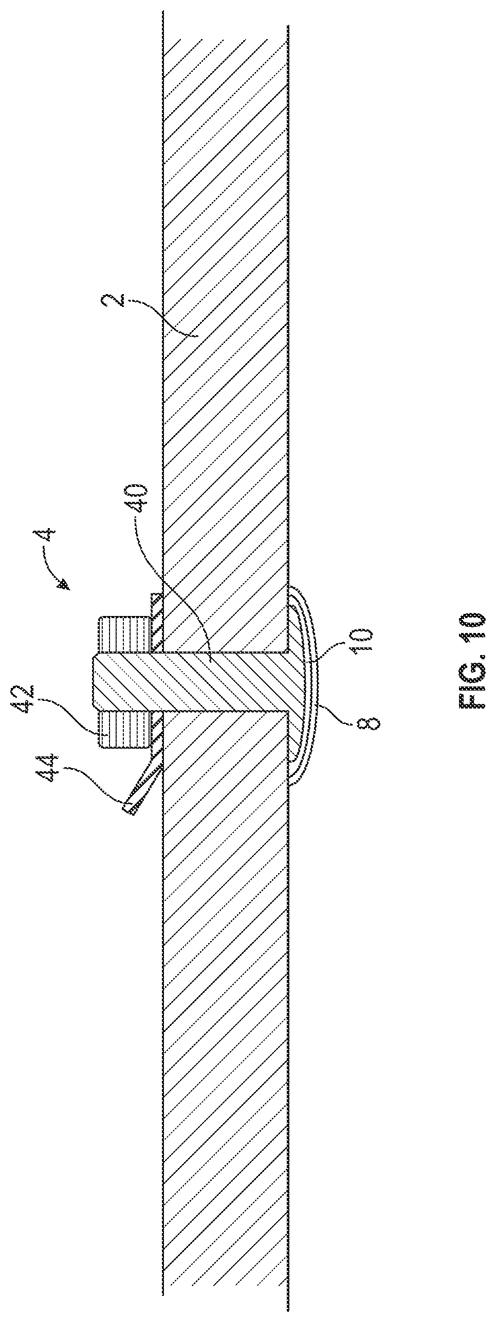 Patent US12097369 Figure 9 – Orthopedic device