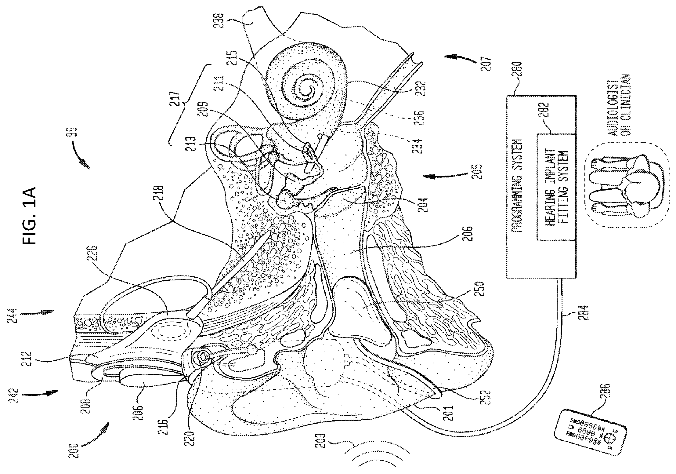 Patent US12097370 Figure 1 – Multimodal prescription techniques