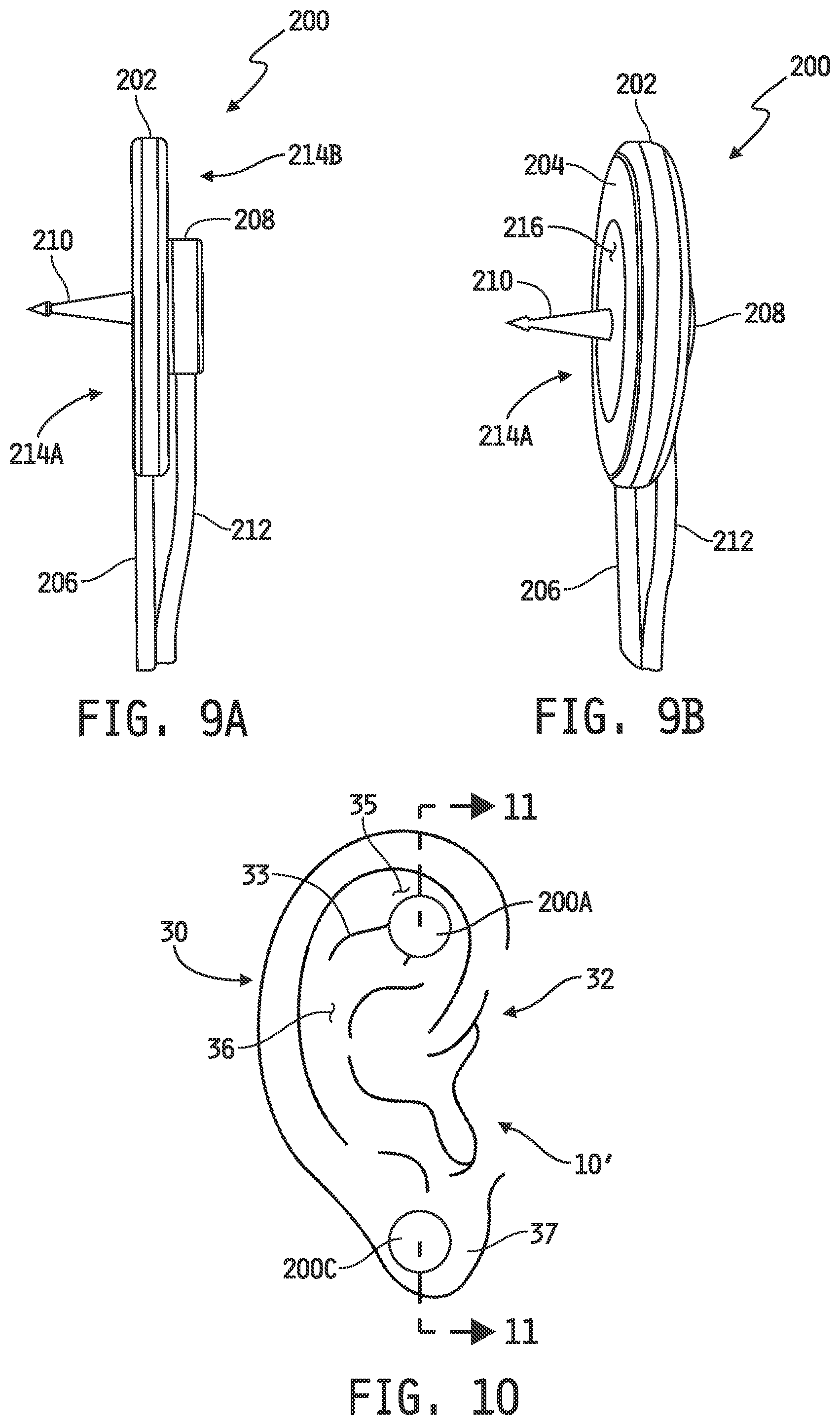 Patent US12097371 Figure 8 – Auricular nerve field stimulation device