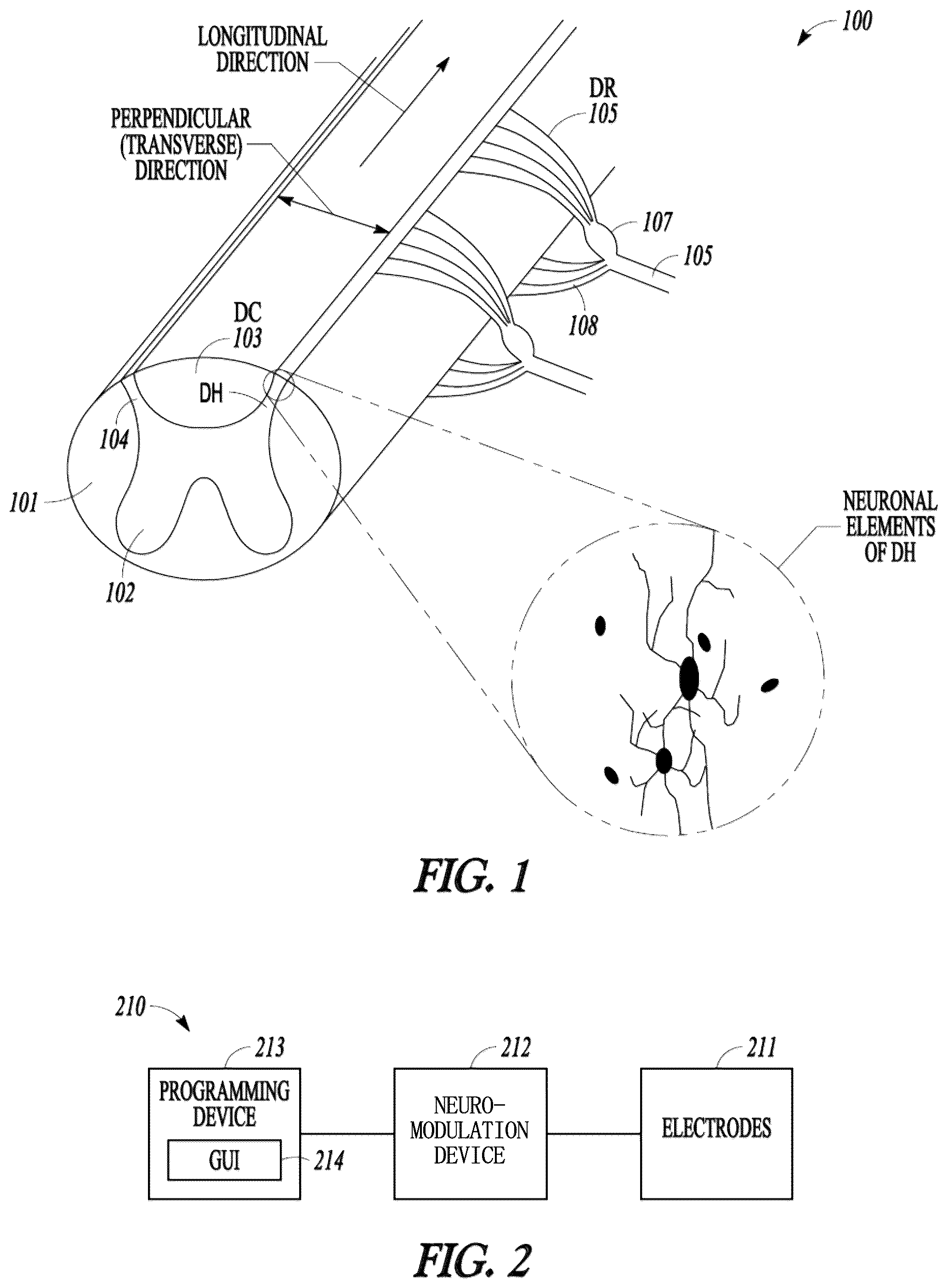 Patent US12097372 Figure 1 – Targeted electrostimulation fields based on focal dermatomal coverage