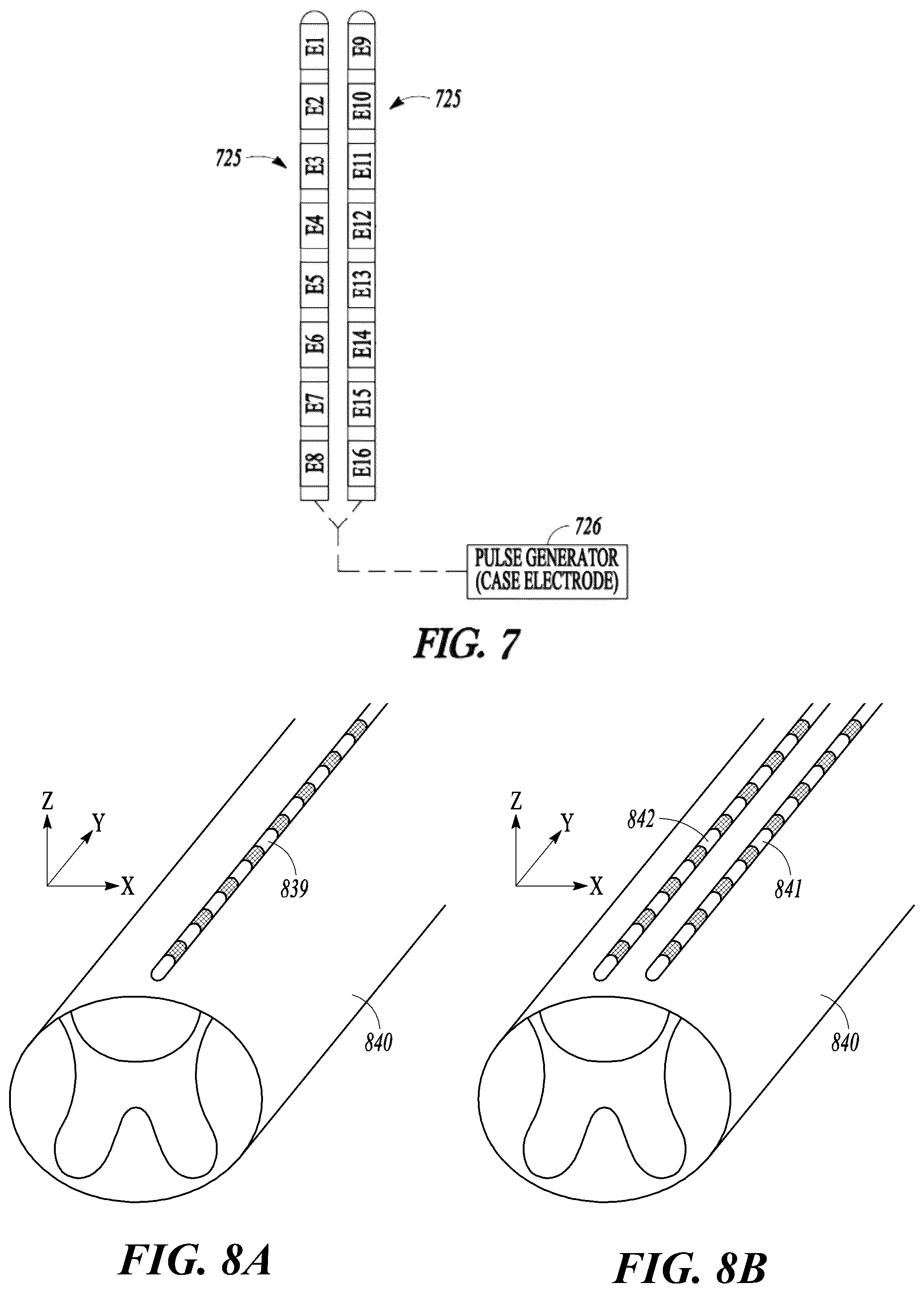 Patent US12097372 Figure 5 – Targeted electrostimulation fields based on focal dermatomal coverage