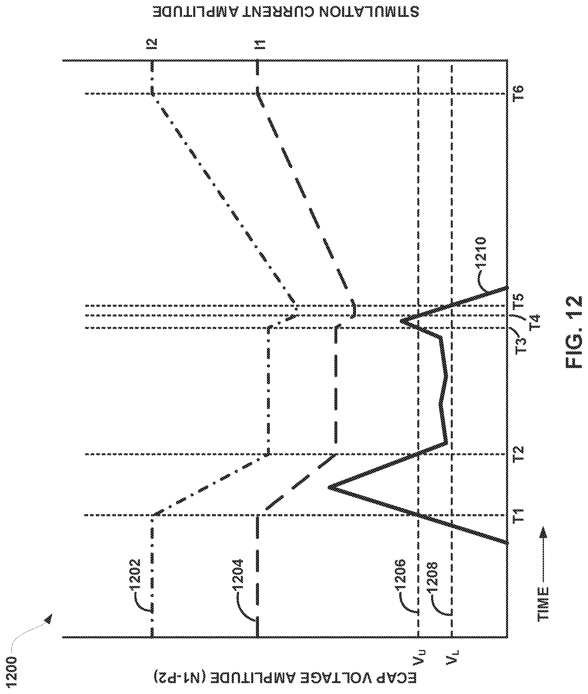 Patent US12097373 Figure 14 – Control policy settings for electrical stimulation therapy