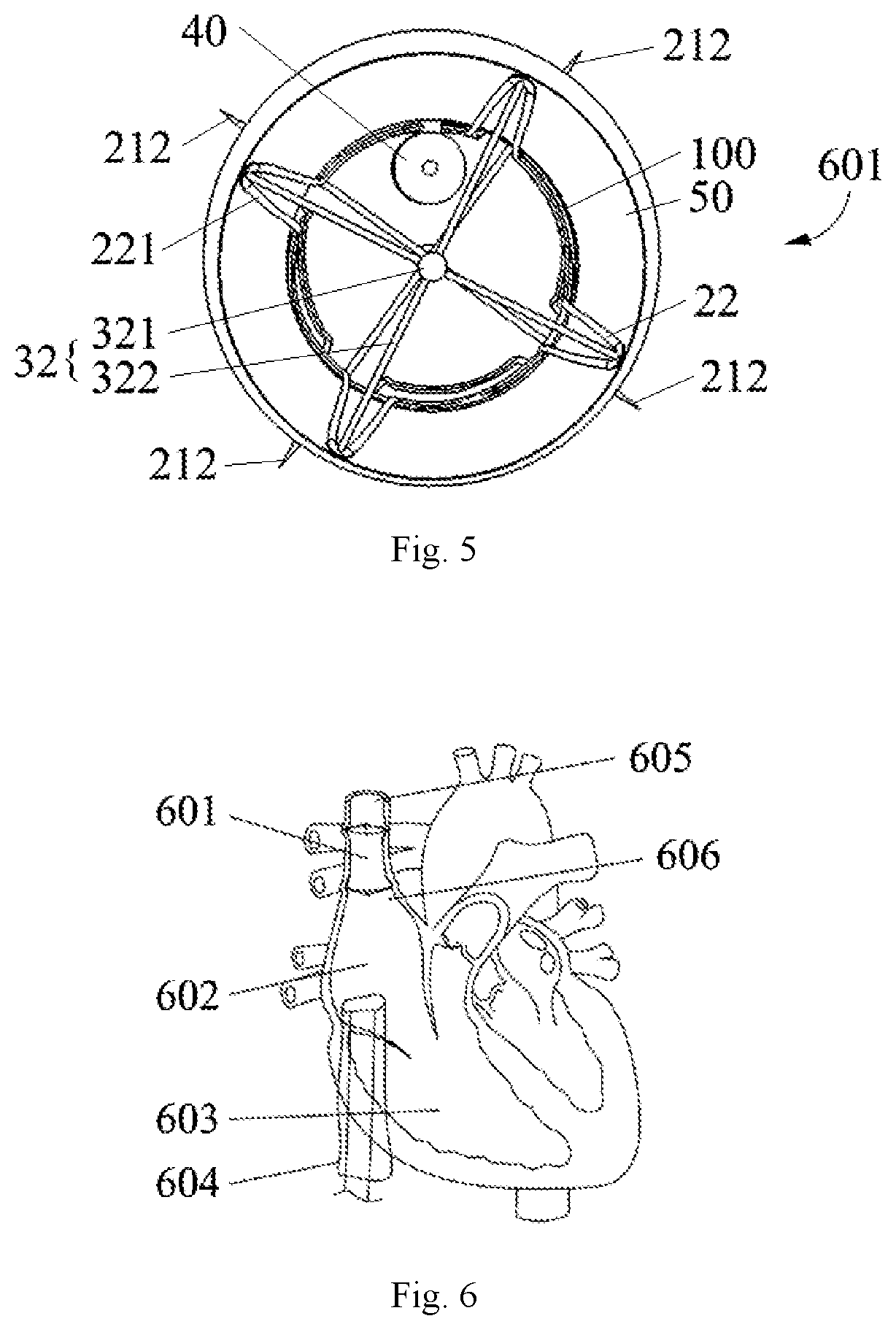 Patent US12097375 Figure 3 – Cardiac pacing system and pacemaker fixing device