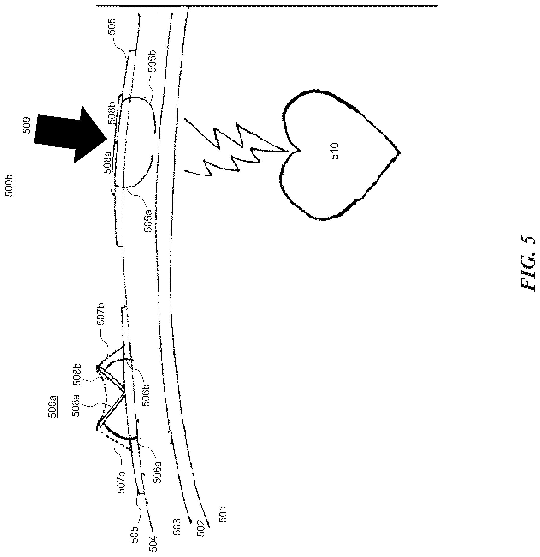 Patent US12097376 Figure 5 – Mobile defibrillator with improved pads, charging, and switching