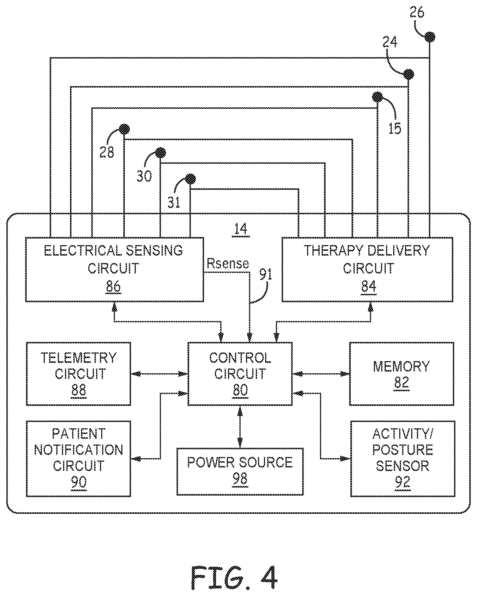 Patent US12097377 Figure 7 – Asystole detection and response in an implantable cardioverter defibrillator