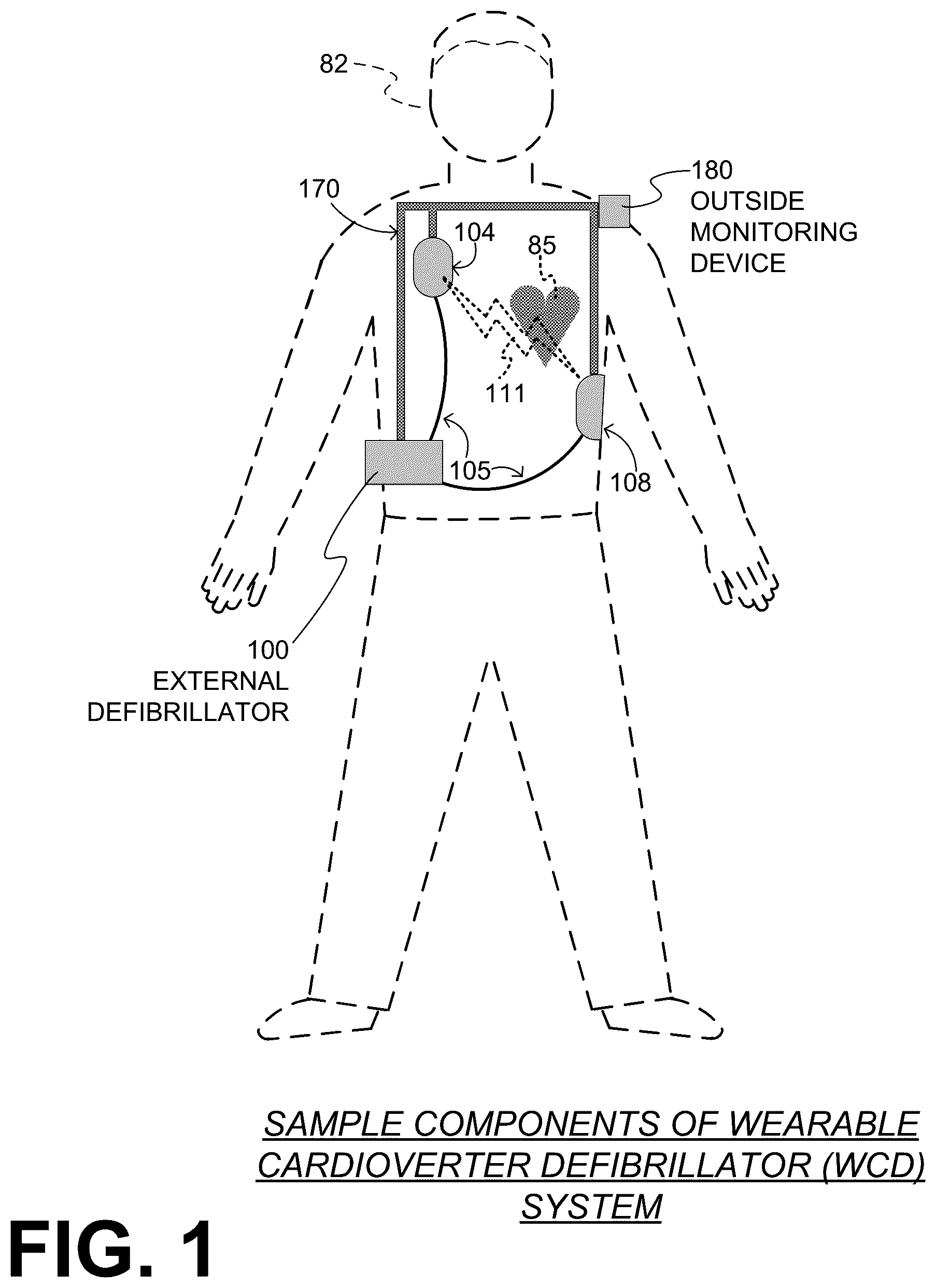 Patent US12097379 Figure 1 – Wearable cardioverter defibrillator (WCD) system making shock/no shock determinations from multiple patient parameters