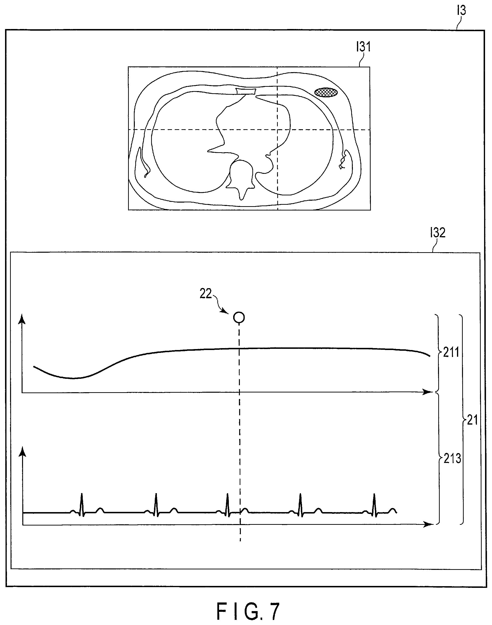 Patent US12097387 Figure 6 – Radiation treatment planning apparatus and radiation treatment apparatus