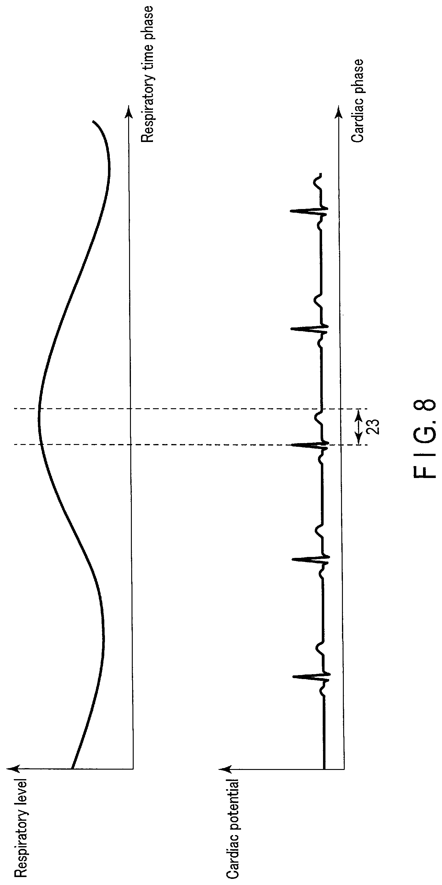 Patent US12097387 Figure 7 – Radiation treatment planning apparatus and radiation treatment apparatus