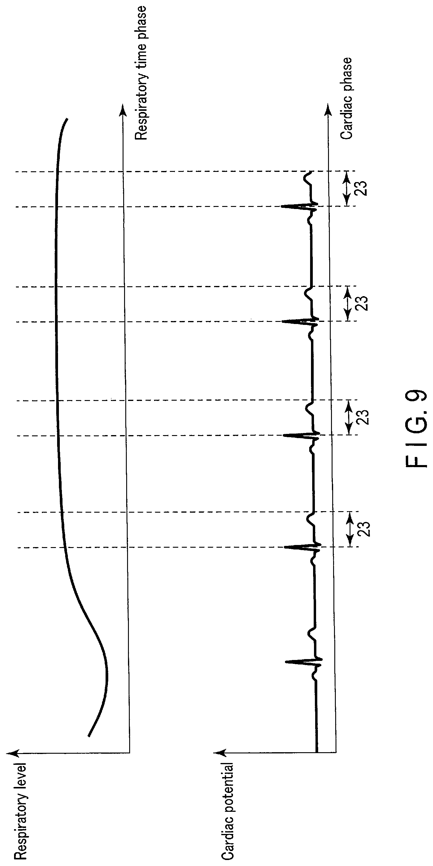 Patent US12097387 Figure 8 – Radiation treatment planning apparatus and radiation treatment apparatus