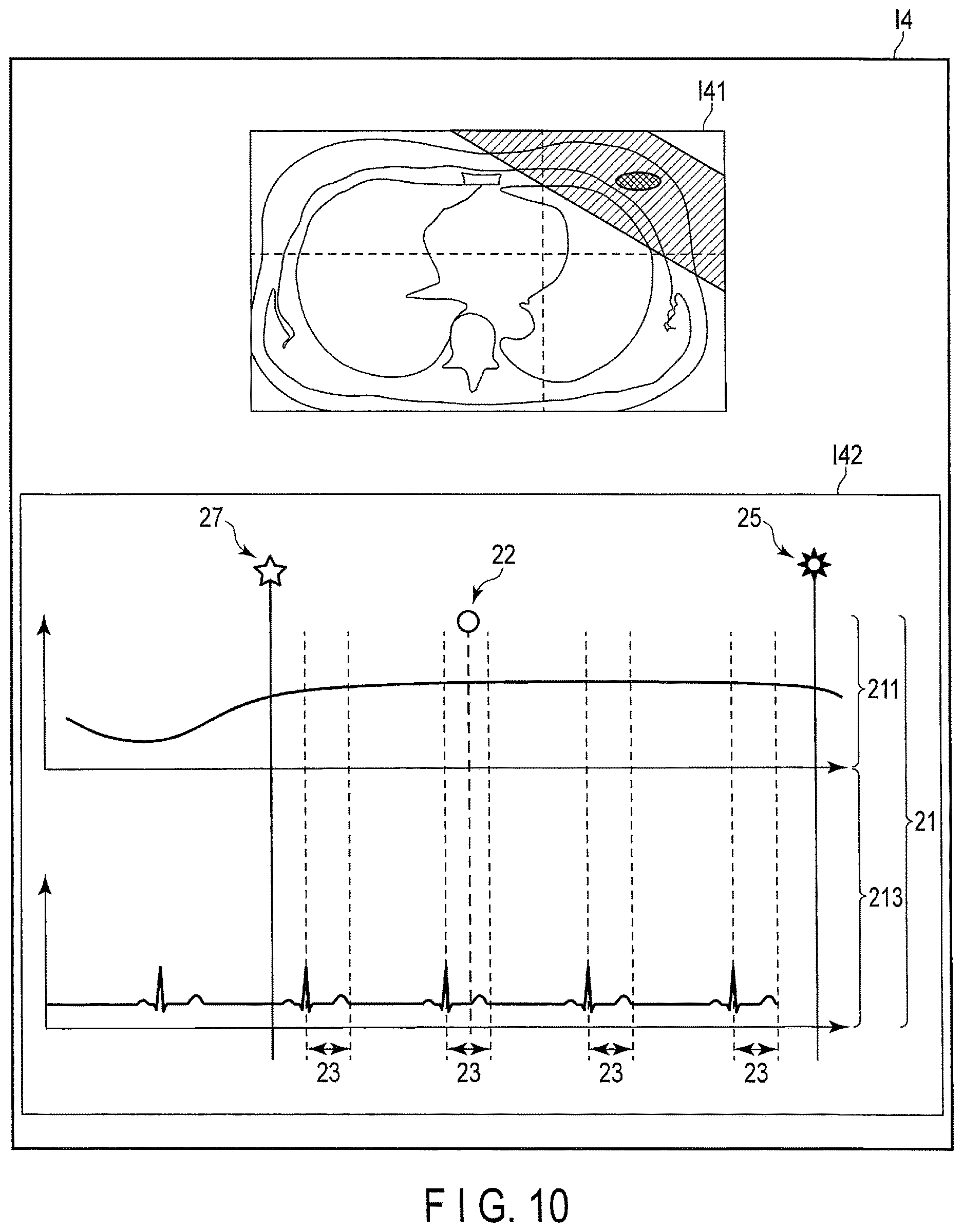 Patent US12097387 Figure 9 – Radiation treatment planning apparatus and radiation treatment apparatus