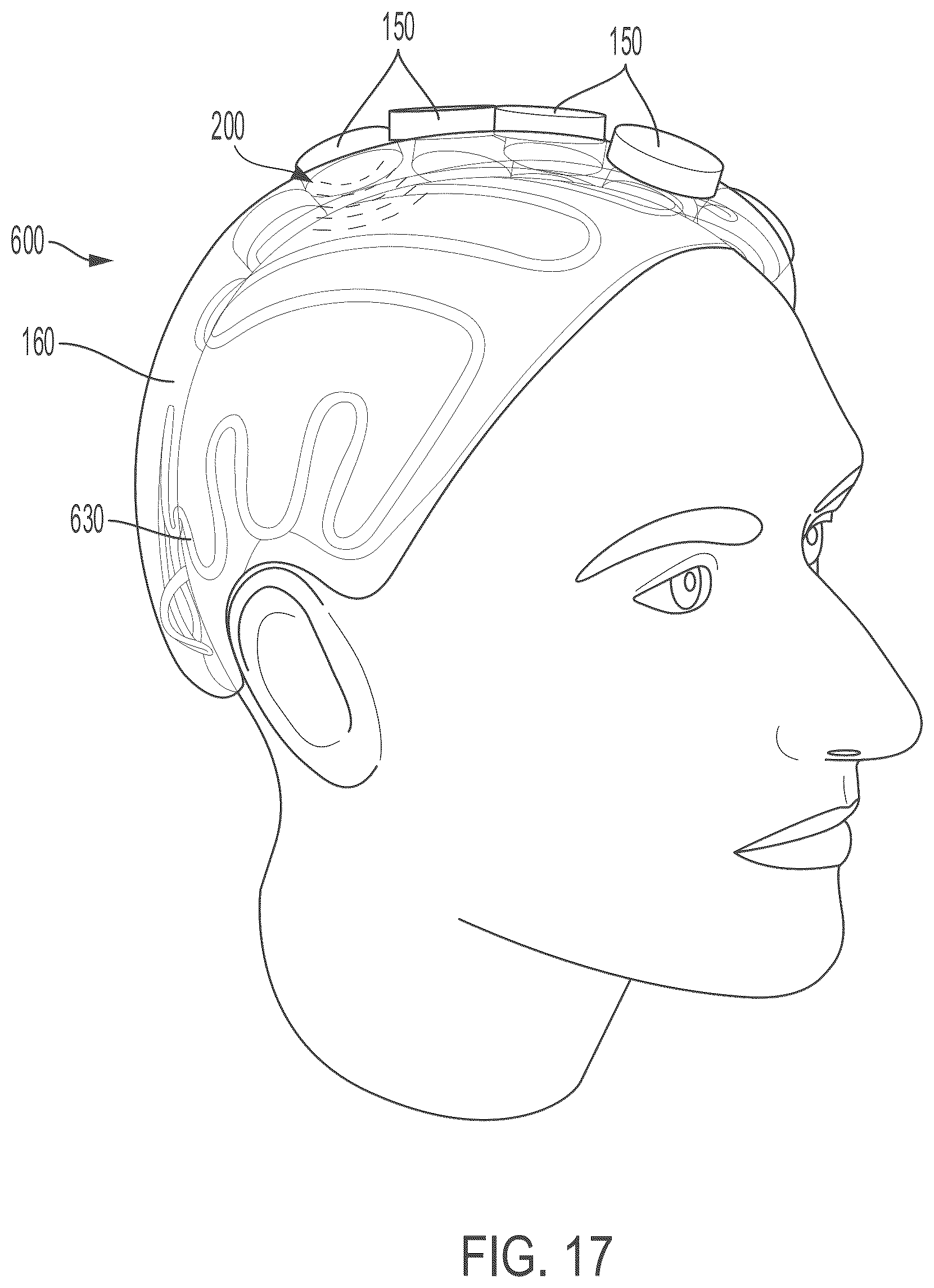 Patent US12097392 Figure 16 – Incoherent field sonodynamic therapy for treating cancer