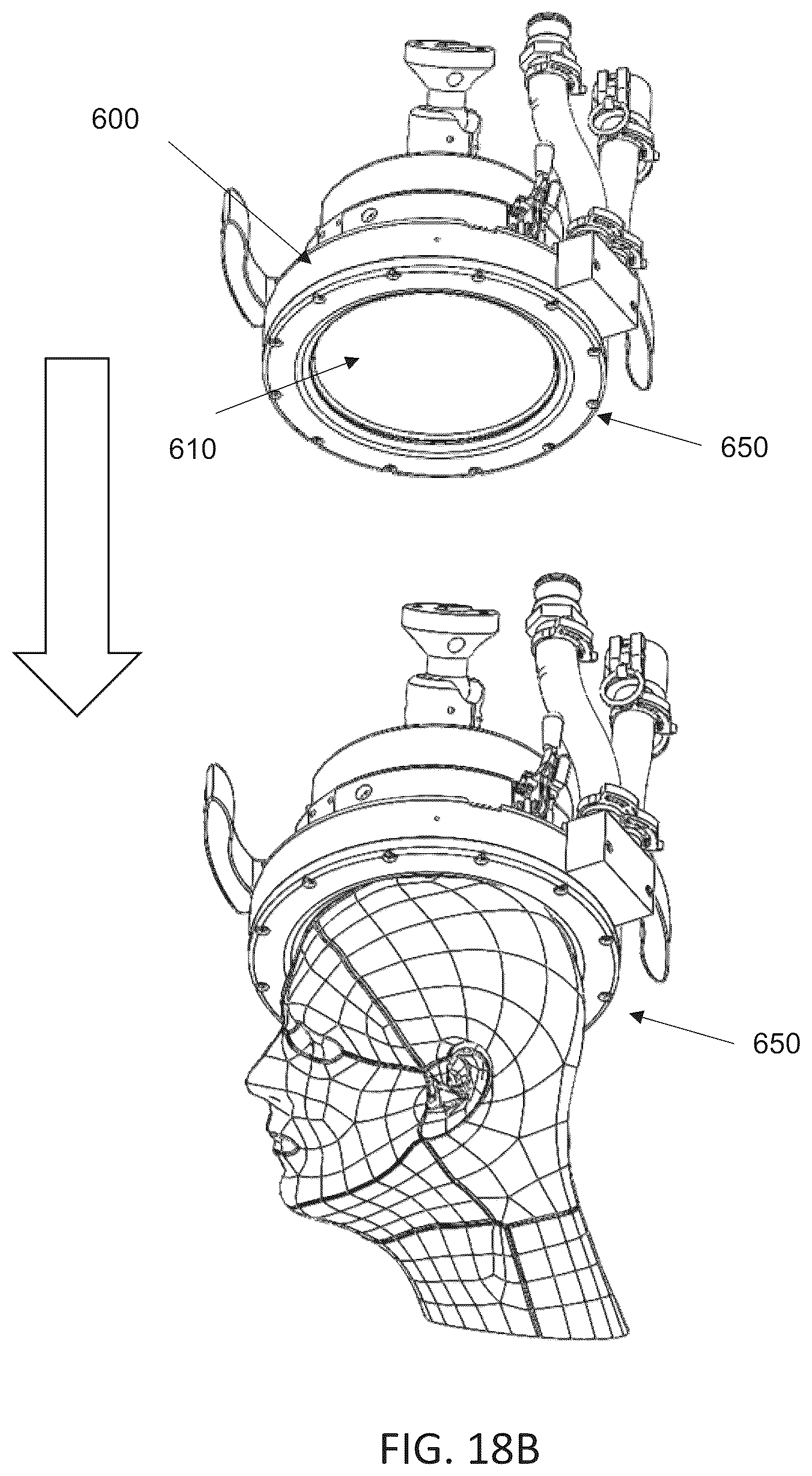 Patent US12097392 Figure 18 – Incoherent field sonodynamic therapy for treating cancer