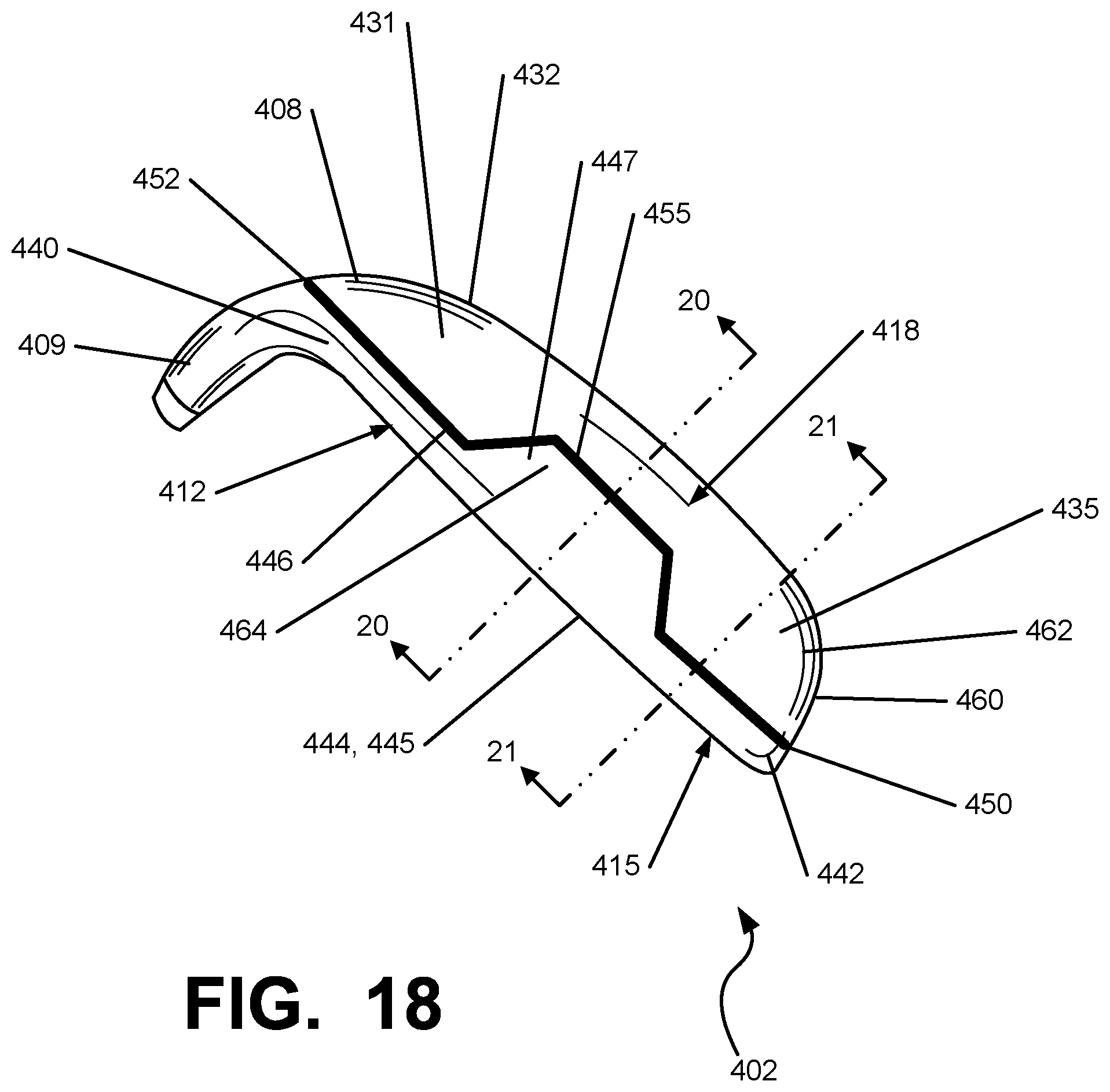 Patent US12097412 Figure 17 – Iron-type golf club head or other ball striking device