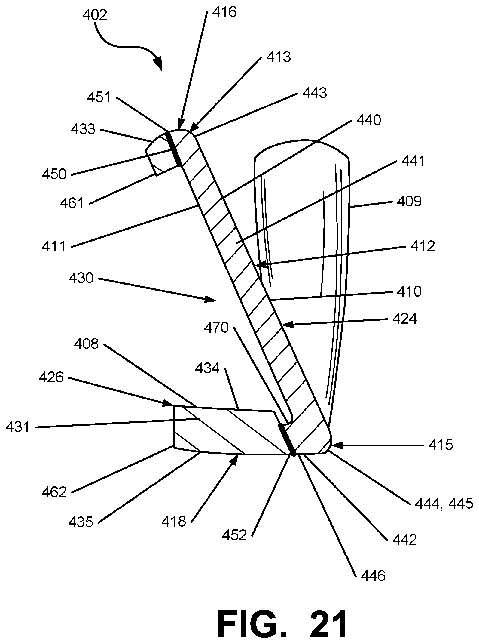 Patent US12097412 Figure 20 – Iron-type golf club head or other ball striking device