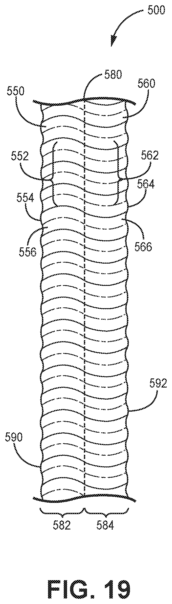 Patent US12097459 Figure 19 – Fluted filtration media, filtration media packs, and filtration elements