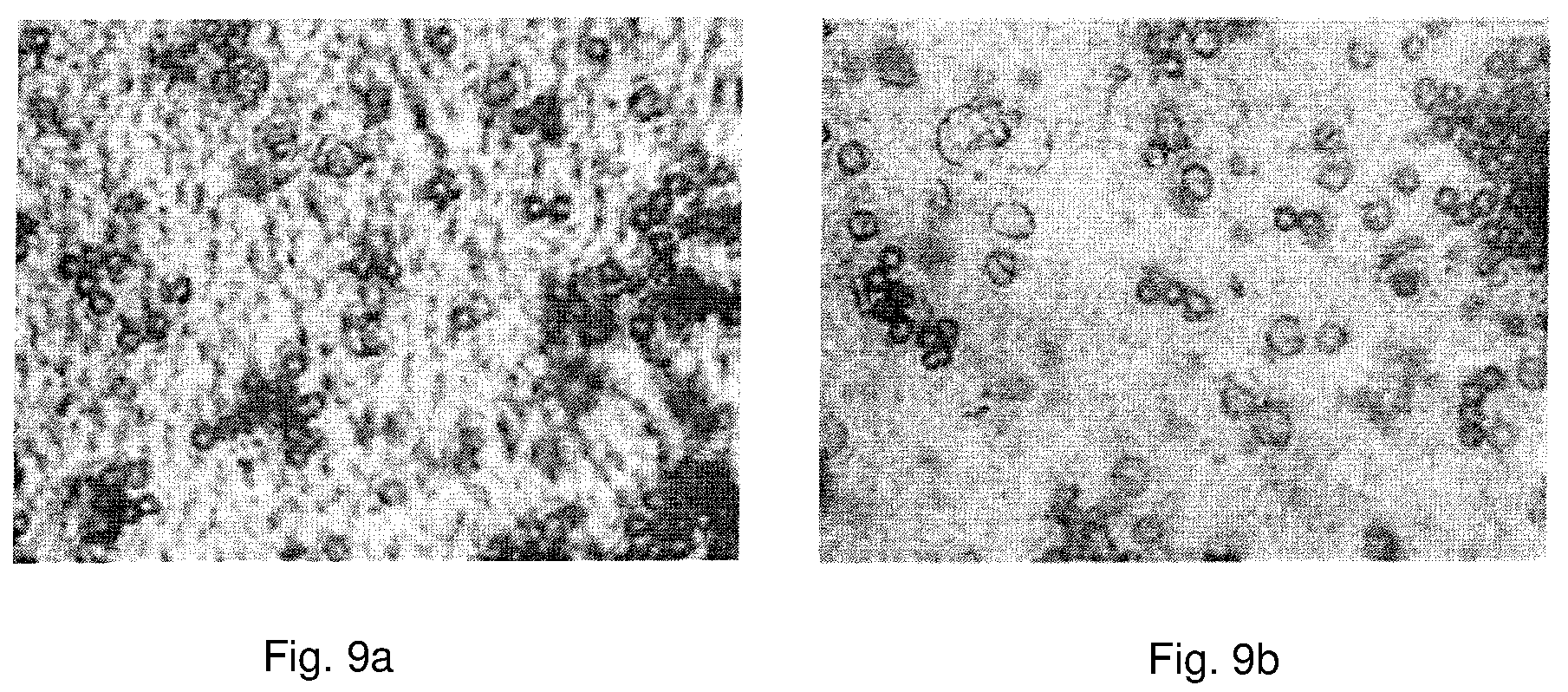 Patent US12097469 Figure 5 – Cross-flow membrane filtration channel
