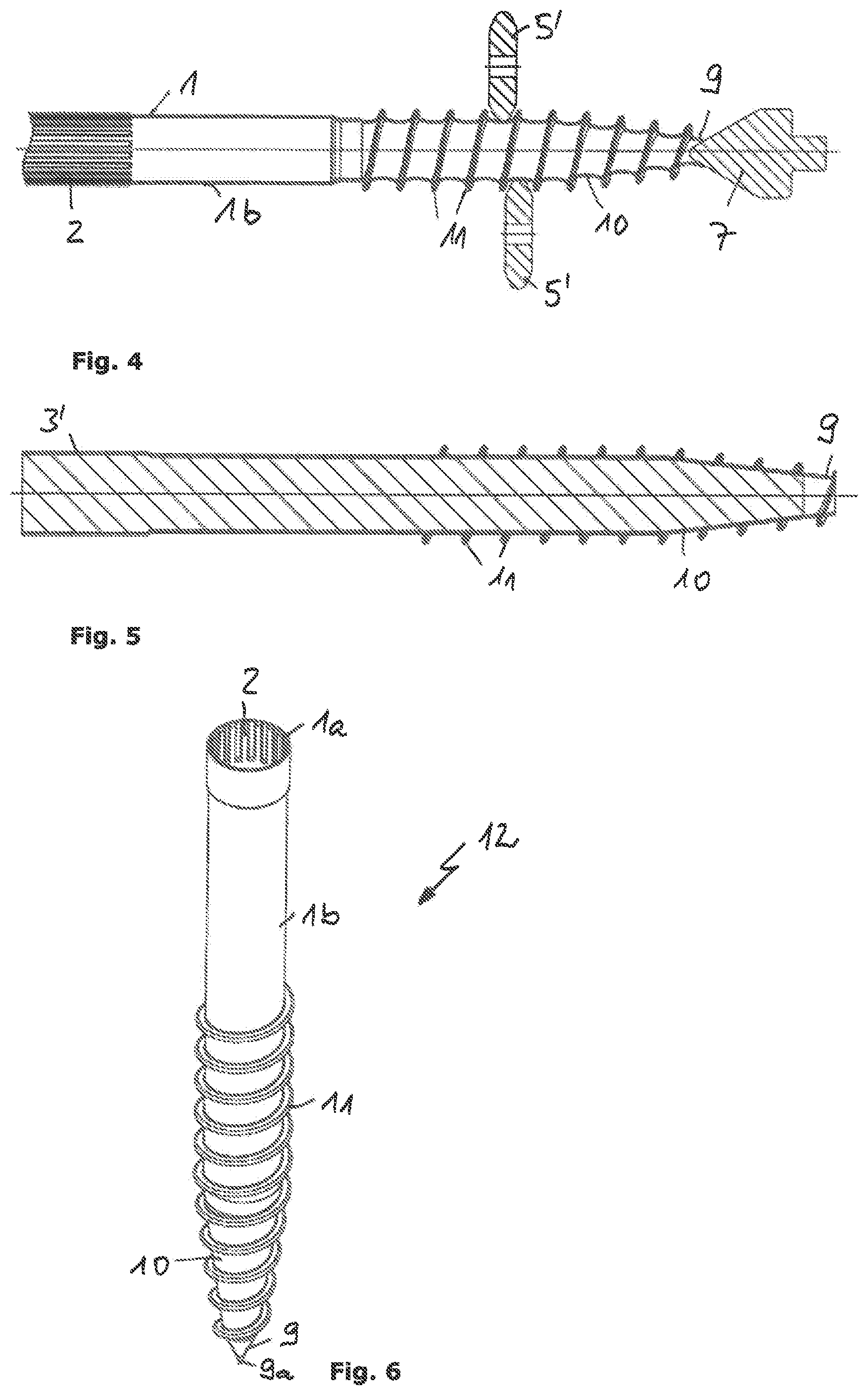 Patent US12097551 Figure 2 – Method for producing a screw foundation for securing elements in the ground