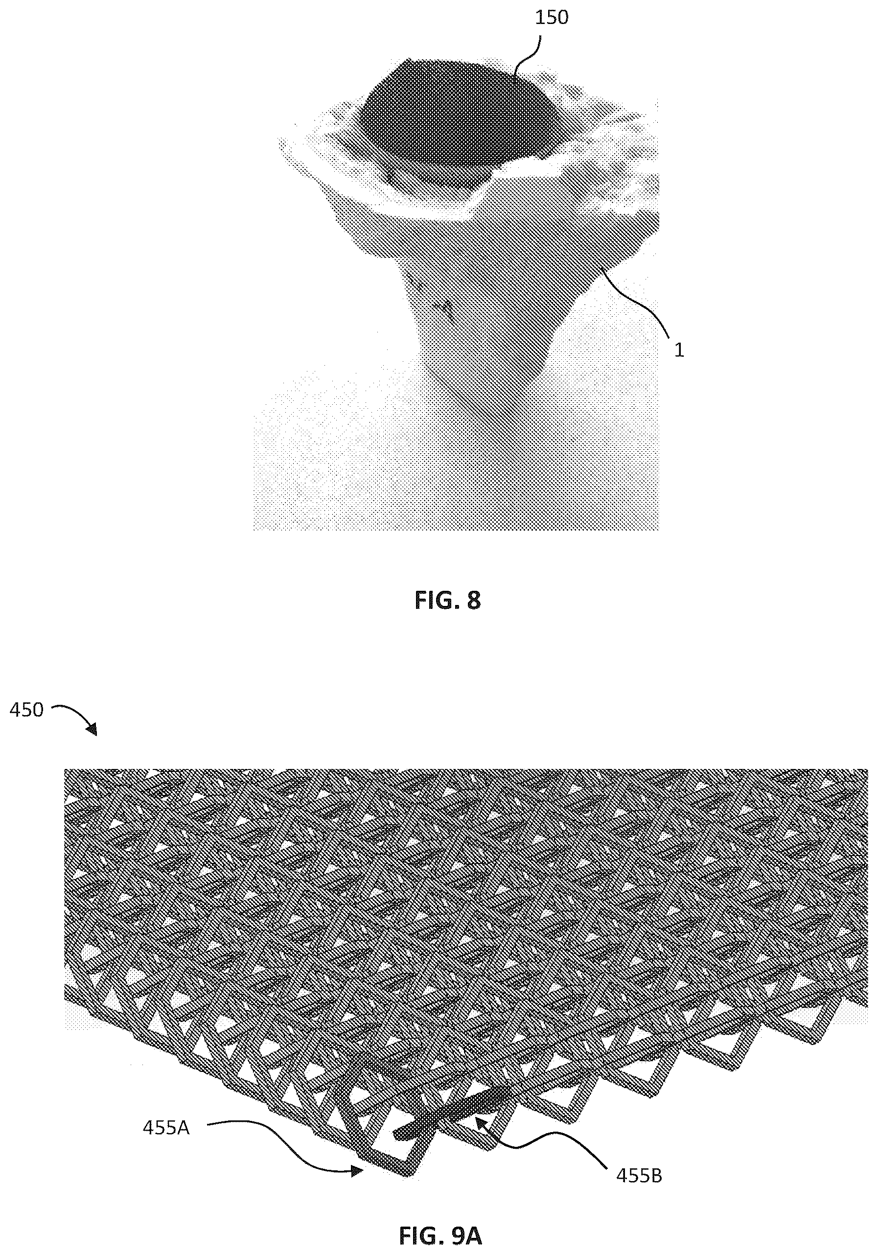 Patent US12097657 Figure 6 – Porous structures produced by additive layer manufacturing
