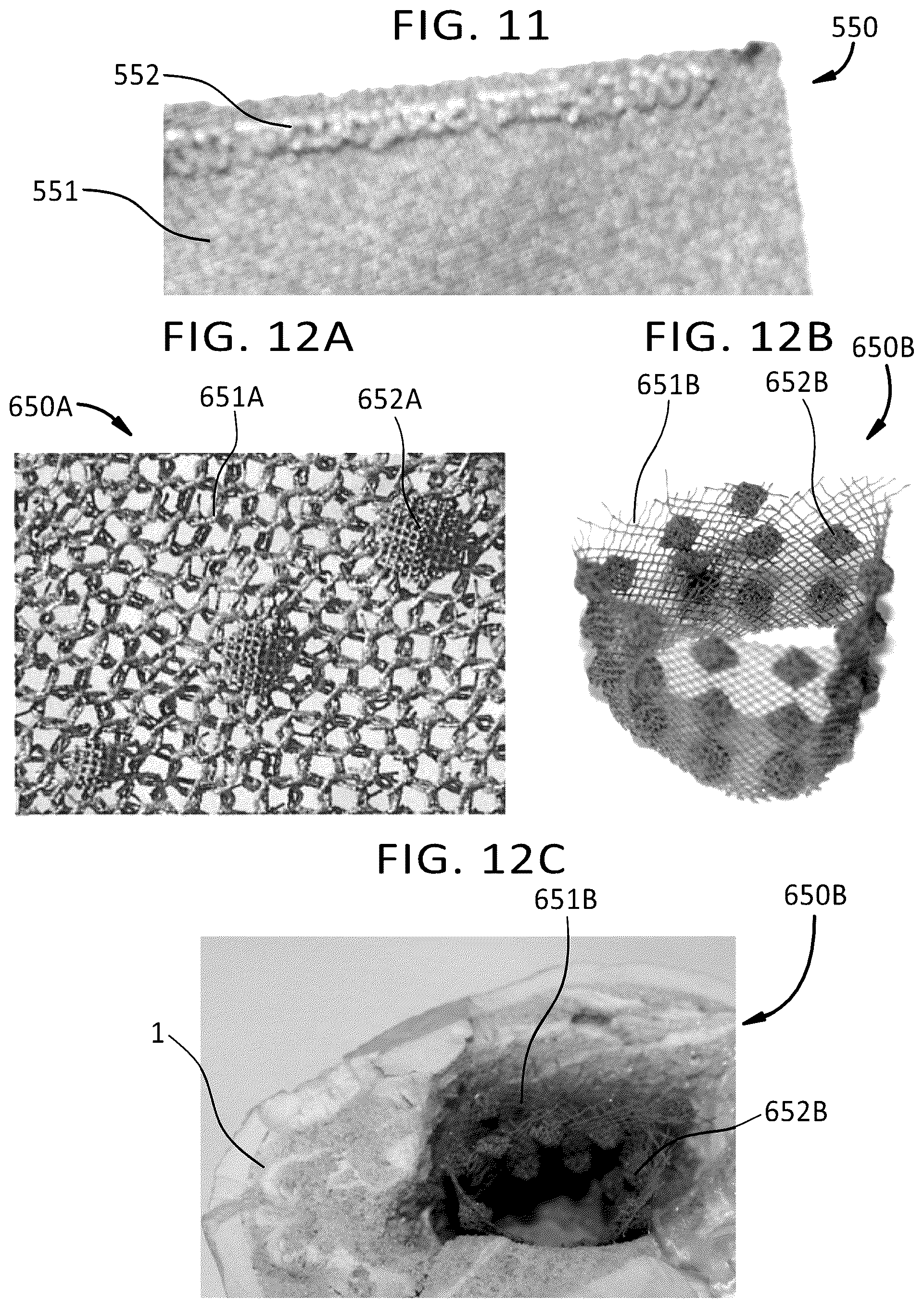 Patent US12097657 Figure 9 – Porous structures produced by additive layer manufacturing