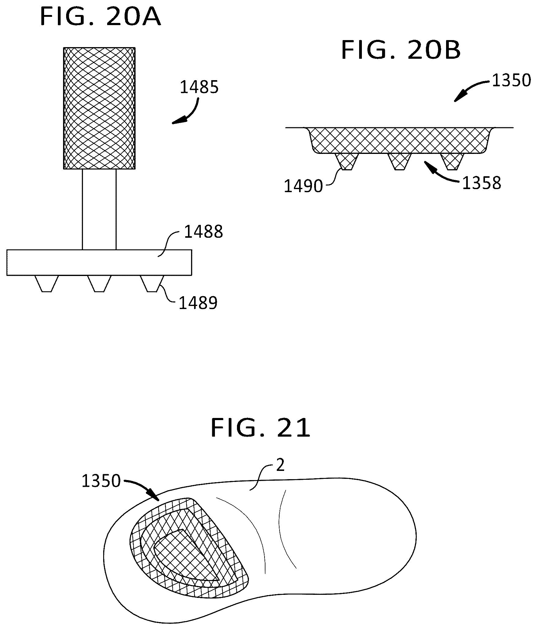 Patent US12097657 Figure 16 – Porous structures produced by additive layer manufacturing