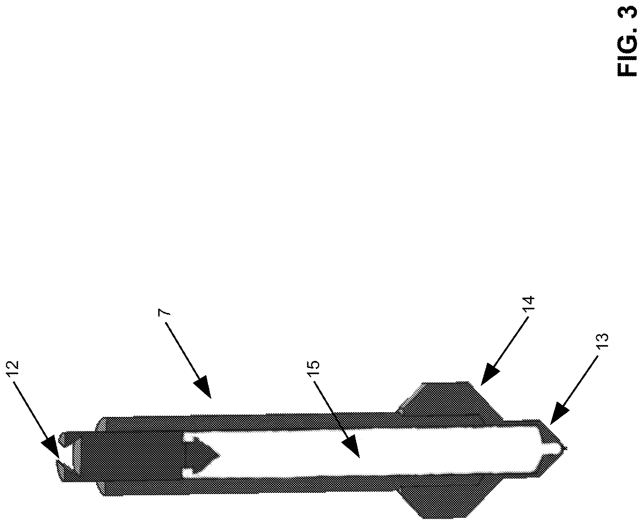 Patent US12097660 Figure 3 – Implantable bone scaffold printed at point of service
