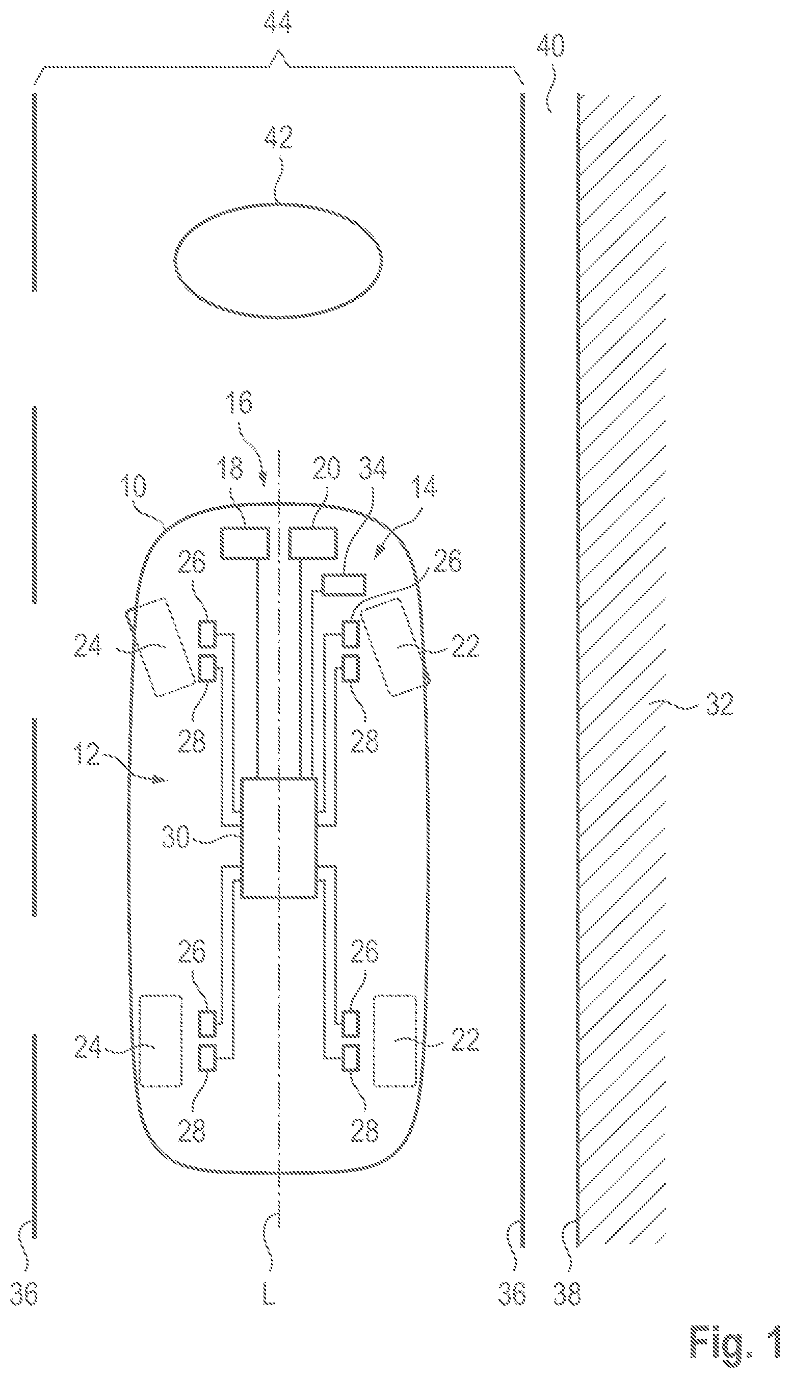 Patent US12097885 Figure 1 – Assistance system and method for avoiding false activations of a shoulder function